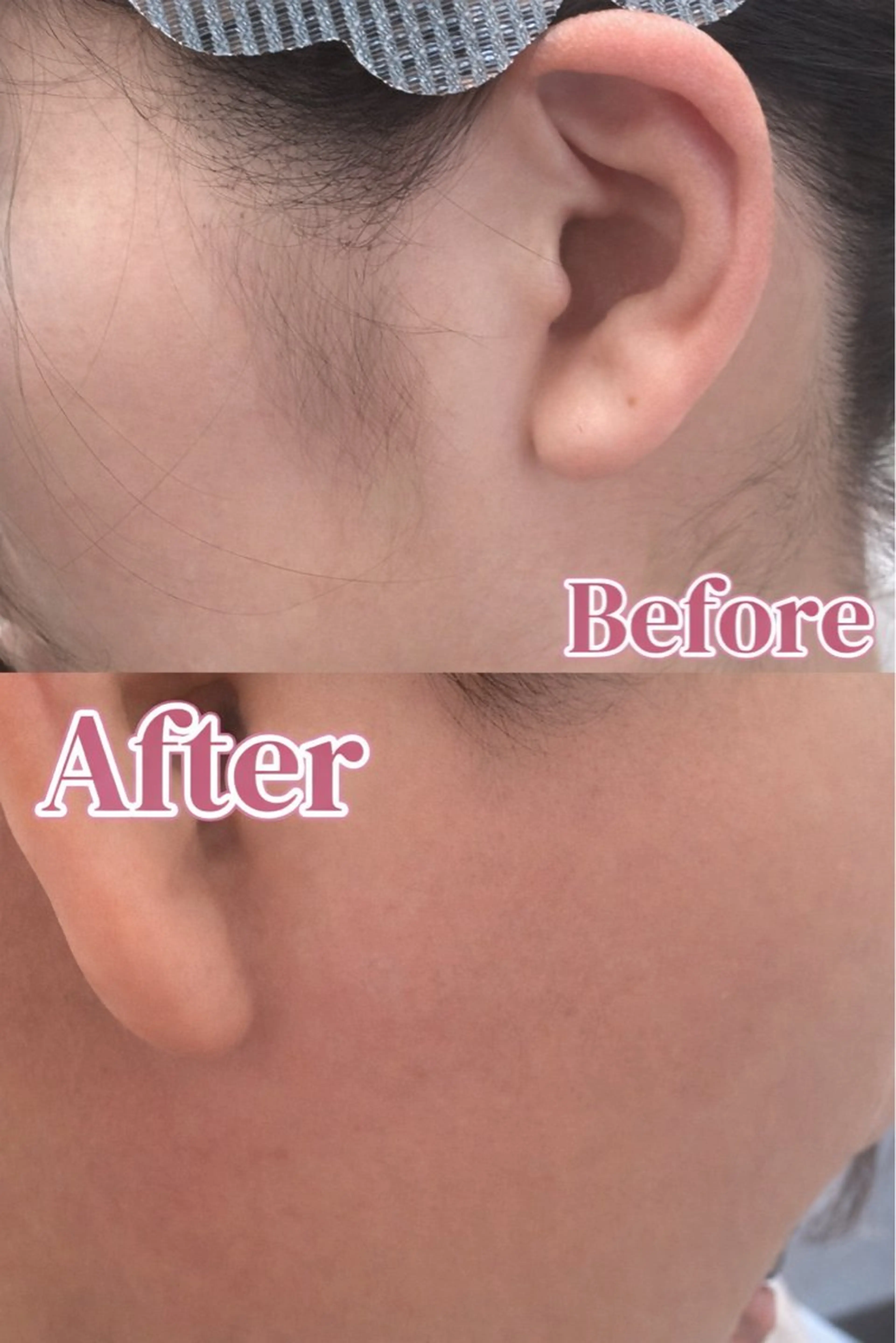 【⭐︎新メニュー⭐︎】もみあげWAXの写真