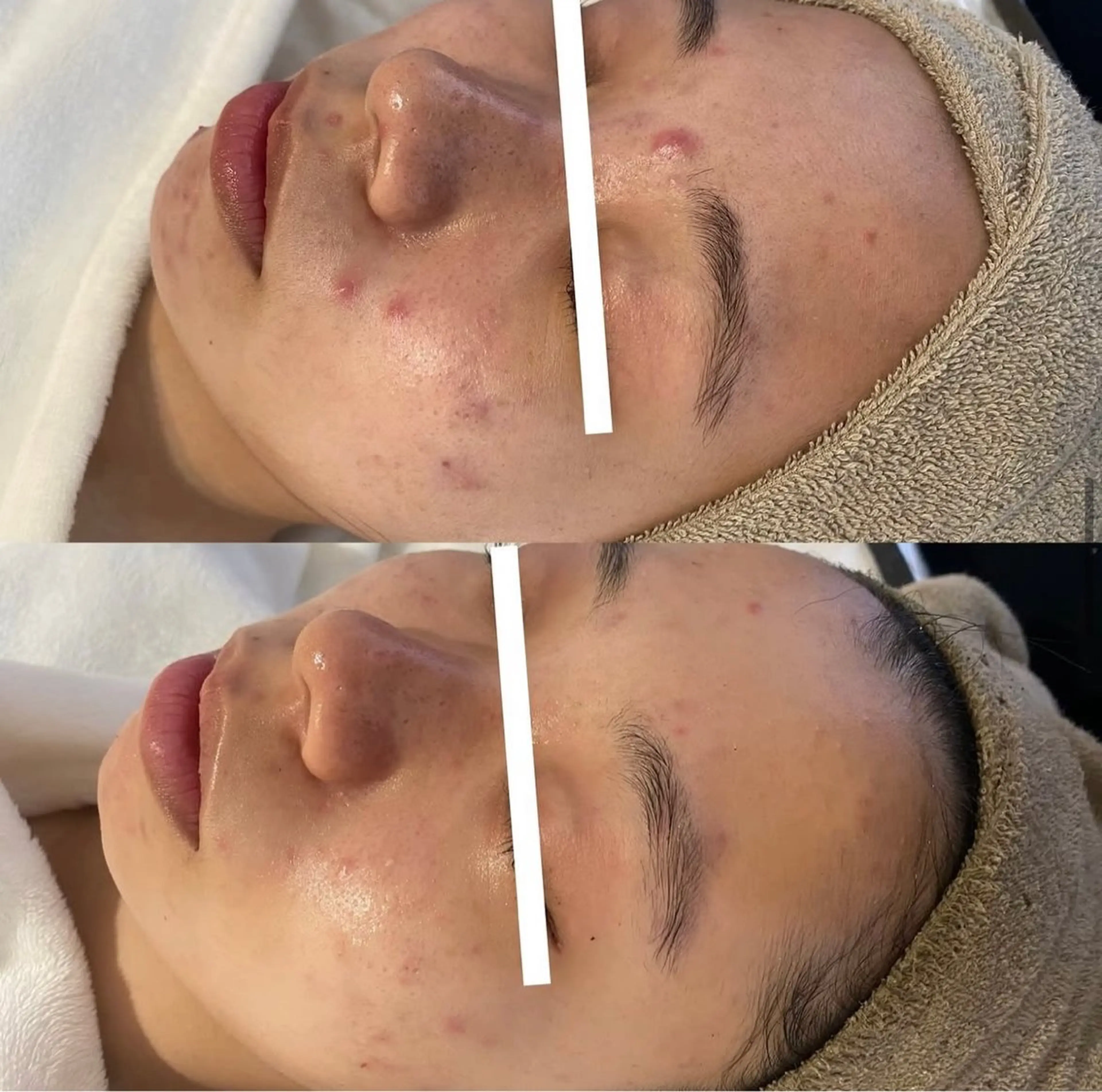 中目黒ハーブピーリン グ🌿ララピールのエステ・リラクイメージ