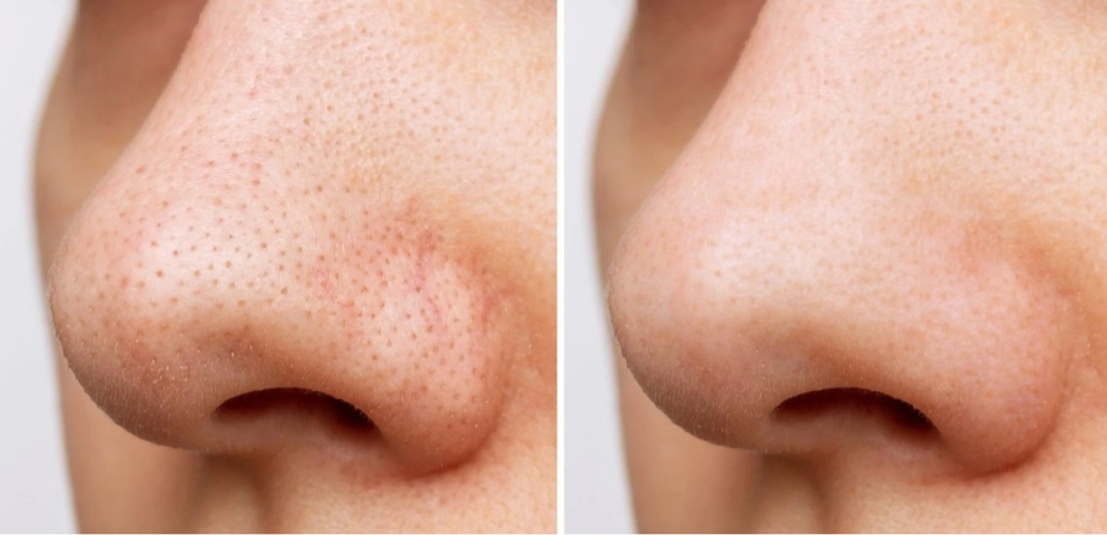 エステ BAUM. 宮村のエステ・リラクイメージ