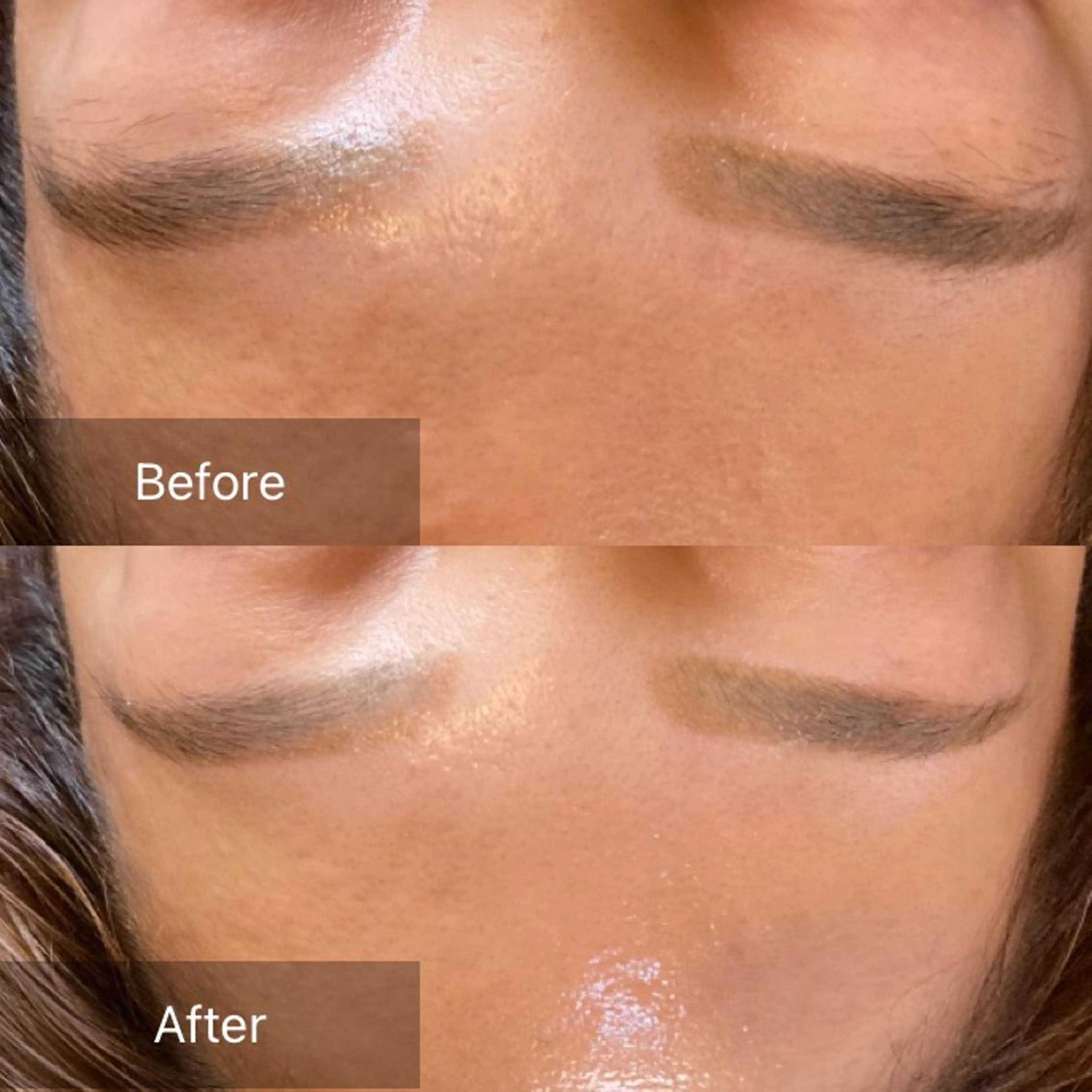 エステ 産毛専門店 Bittoのエステ・リラクイメージ