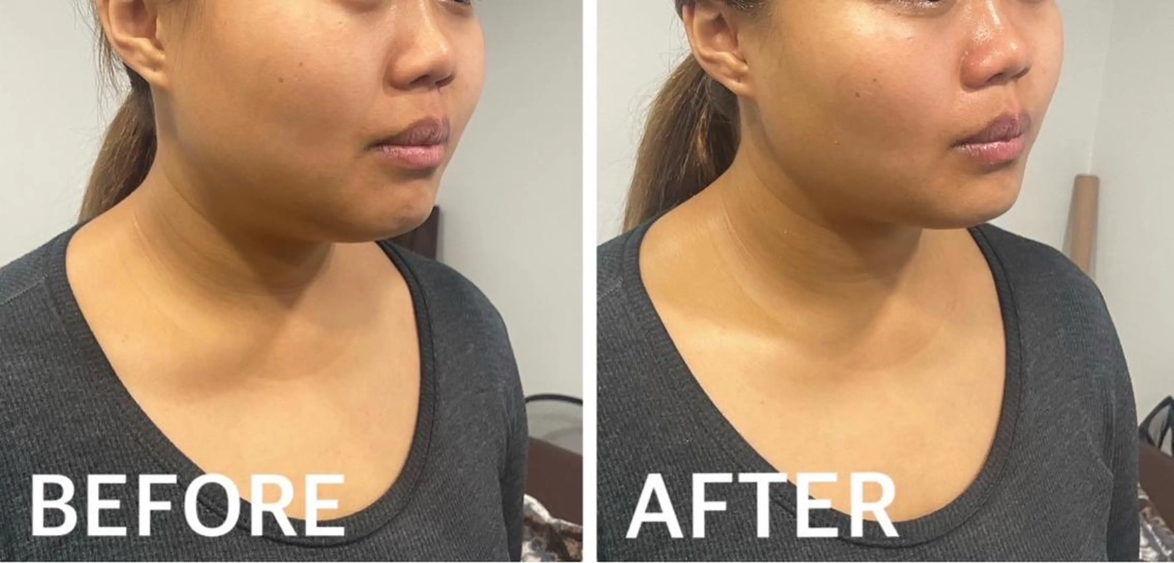 エステ リラク 大阪脱毛|ちぇるま| 眉毛Wax｜美肌管理のエステ・リラクイメージ