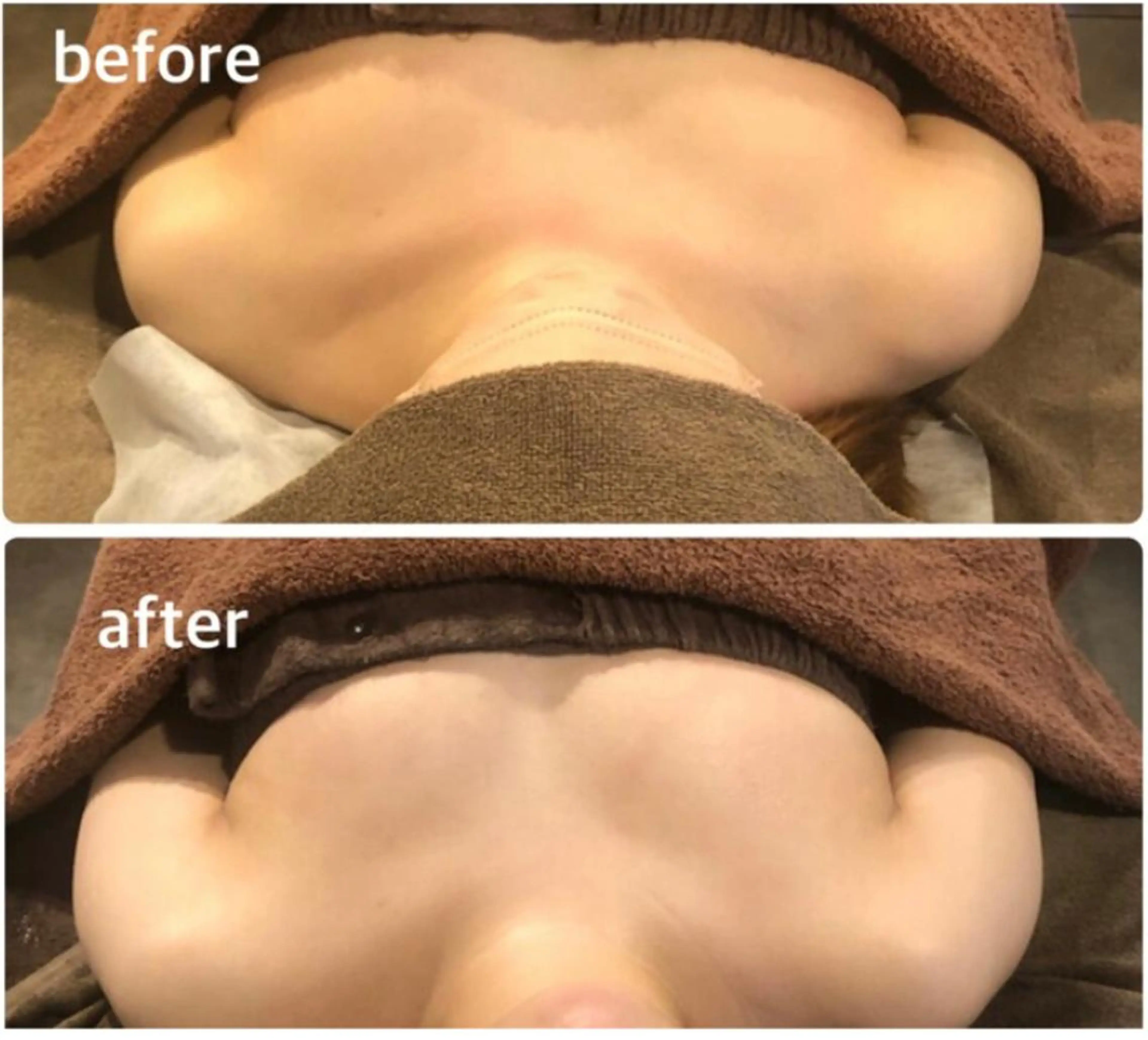 エステ Gemini 　MIKIのエステ・リラクイメージ