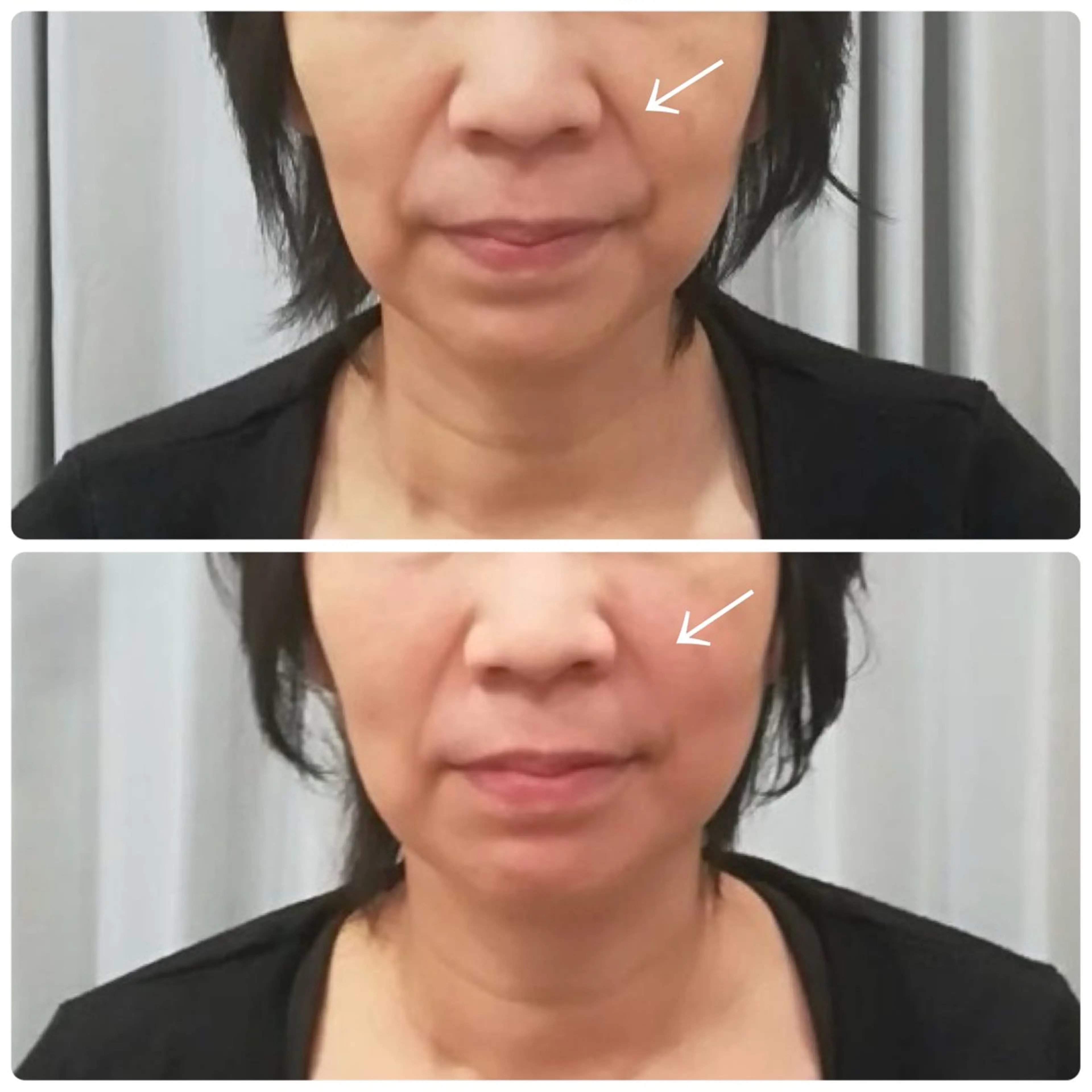 健康×美容鍼鍼灸院 あさば整体院三ノ輪店のエステ・リラクイメージ