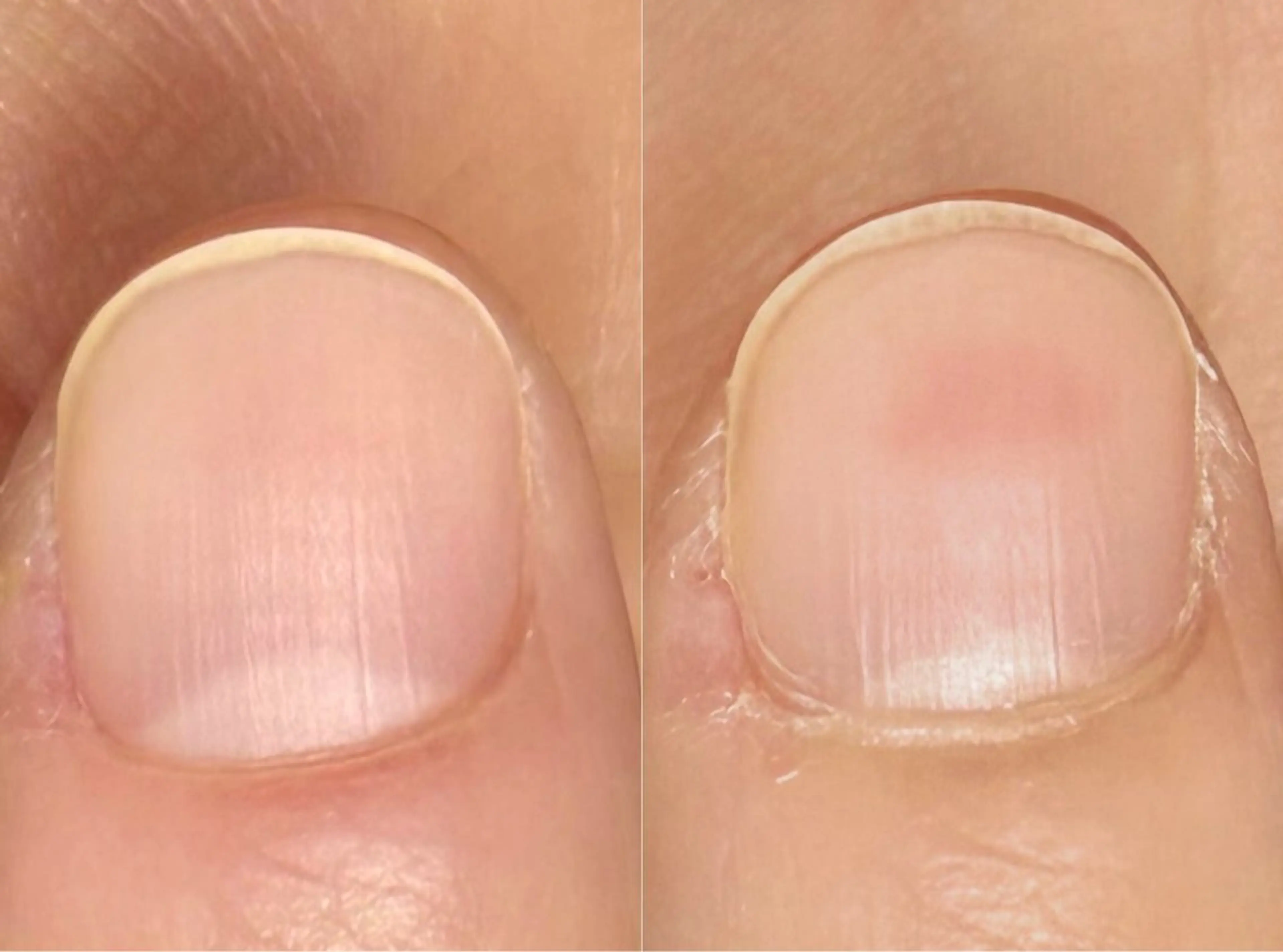 ネイル ハンドネイル ハンドケア 自爪育成・ネイルケア エルメのネイルデザイン