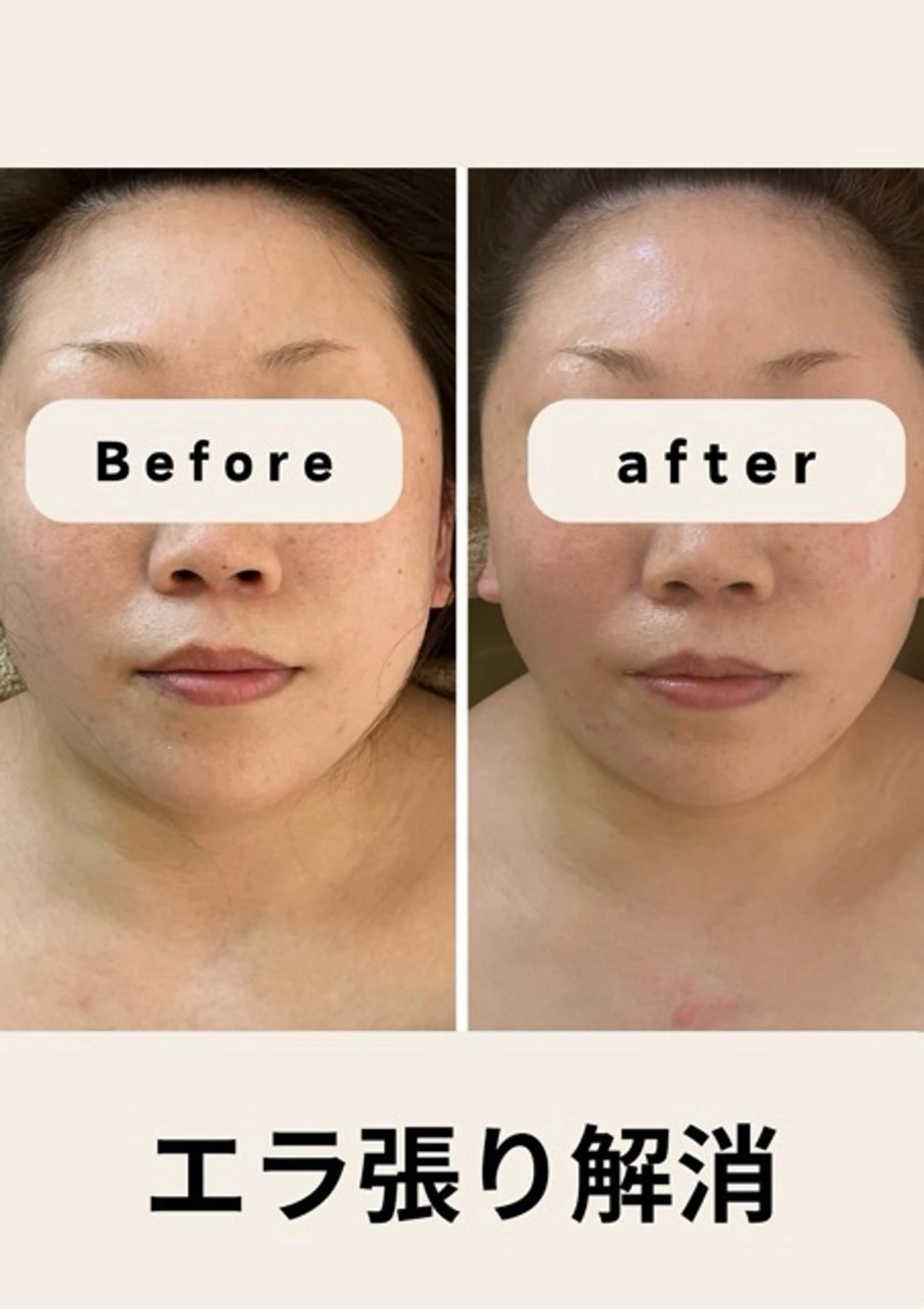 本格小顔コルギサロン ミピマムマールのエステ・リラクイメージ