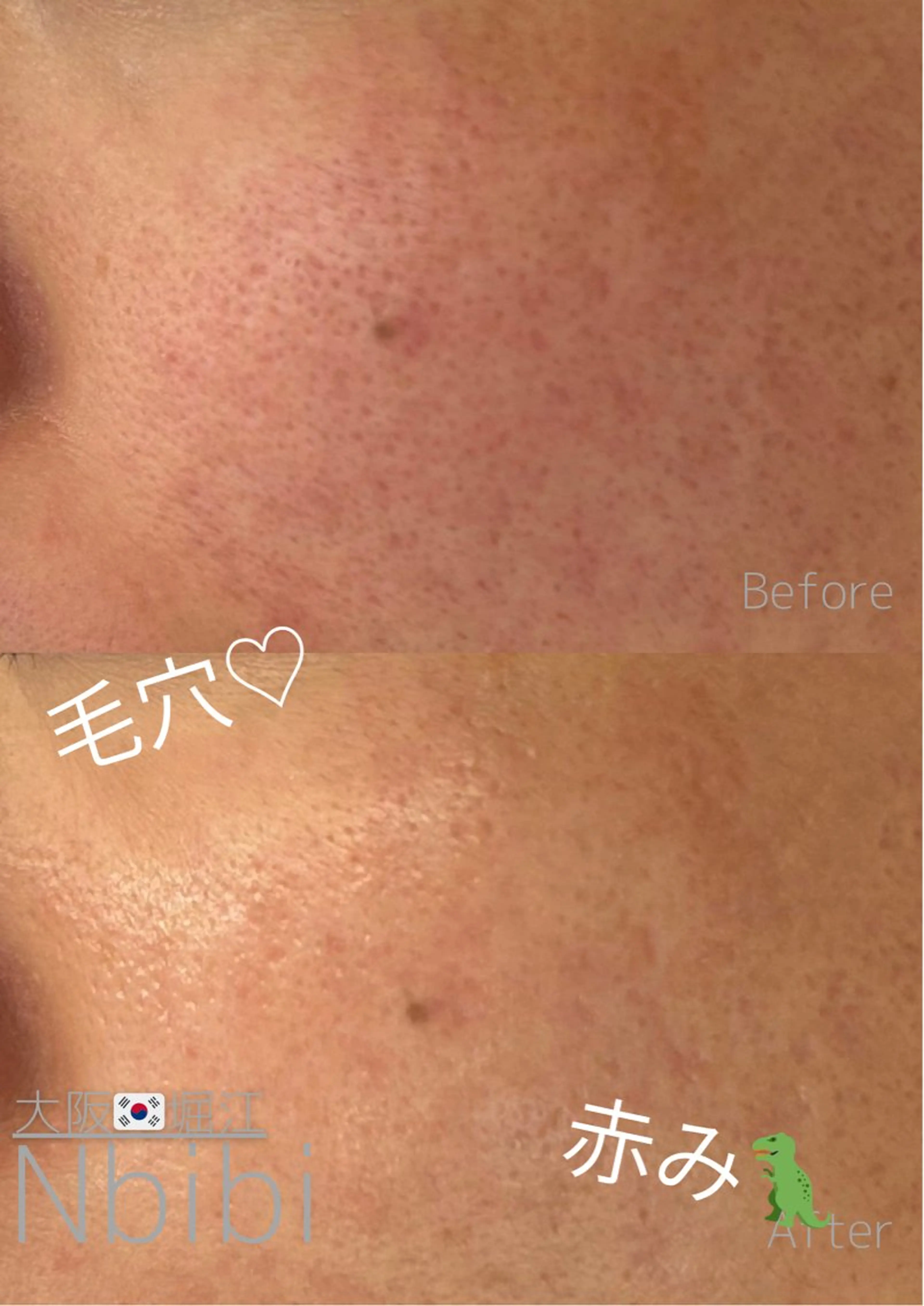 エステ 韓国🇰🇷価格 サロン_Nbibiの眉毛・アイブロウイメージ