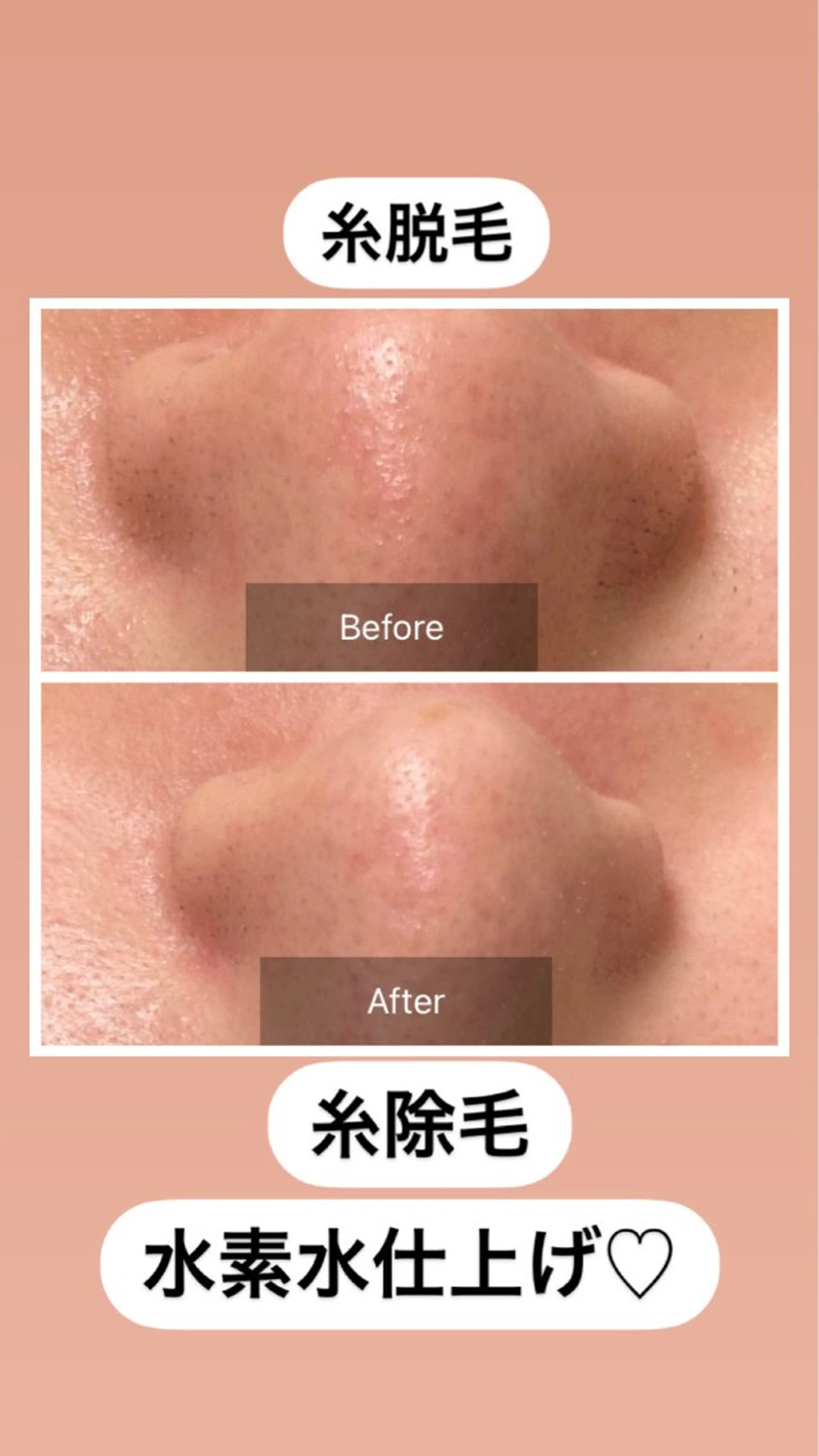 エステ 産毛専門店 Bittoのエステ・リラクイメージ