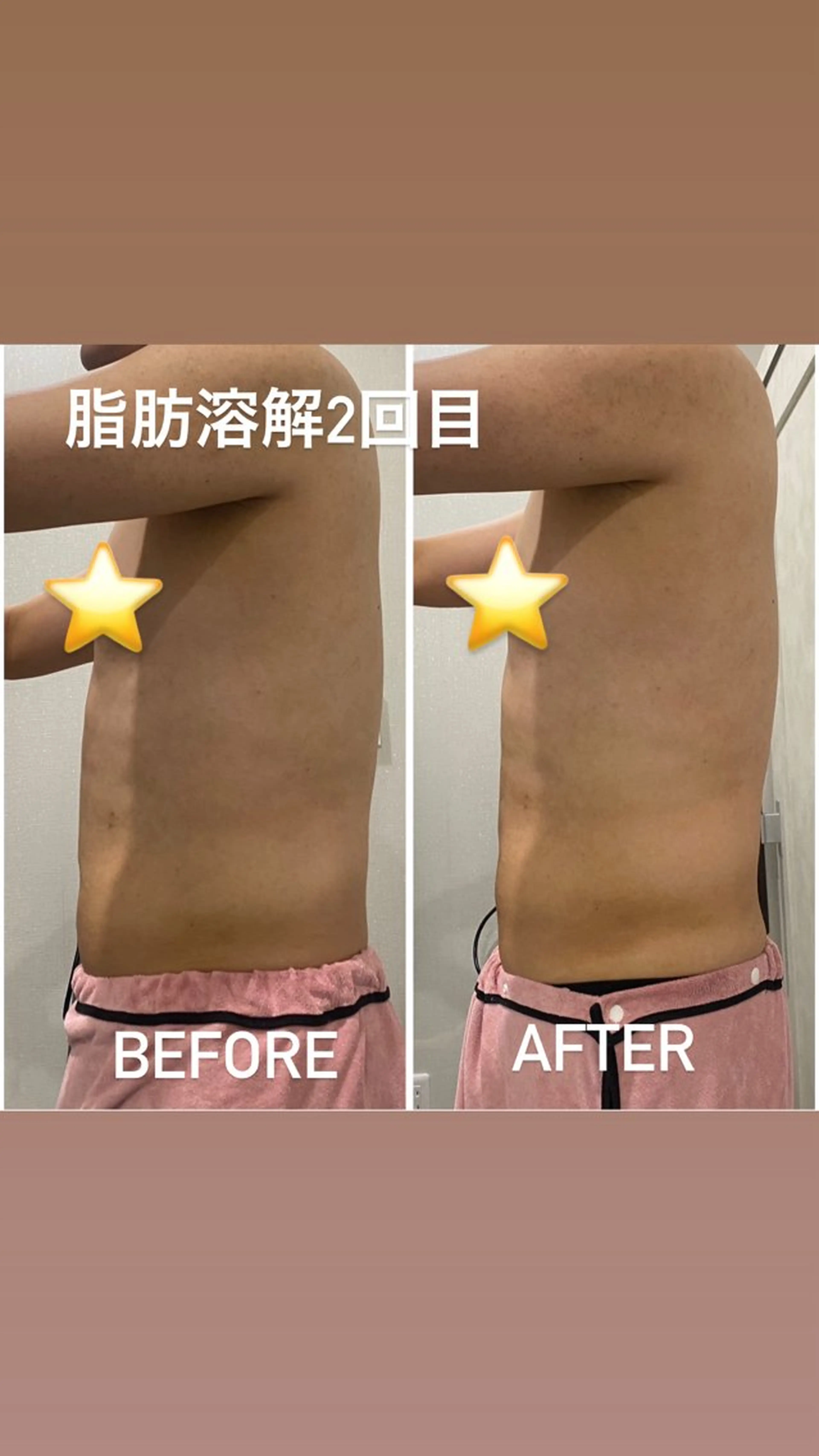 エステ 毛穴洗浄・痩身・脱毛 /アルカンジュのエステ・リラクイメージ