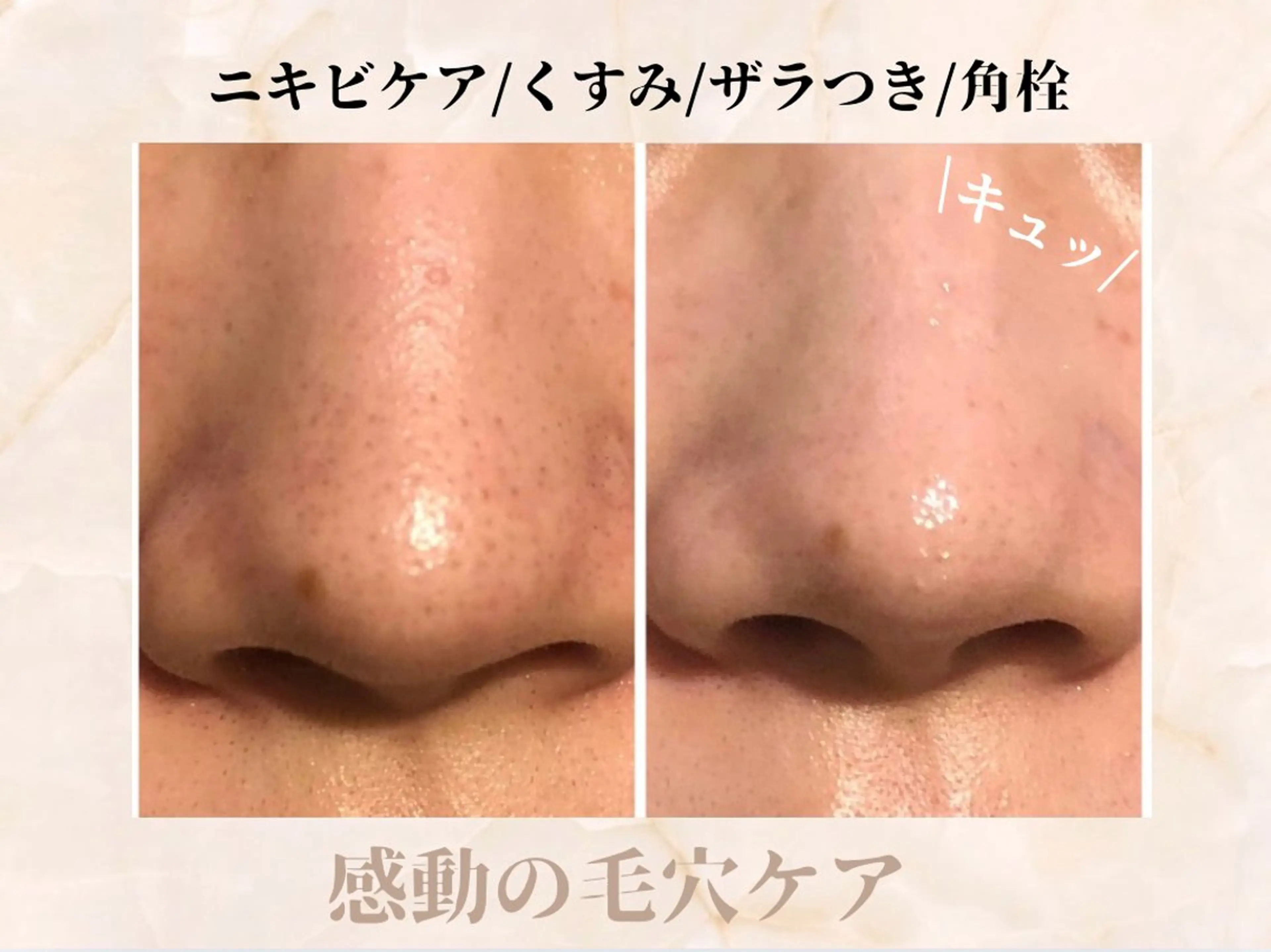 ハイフ・小顔・骨盤 シャングリラのエステ・リラクイメージ