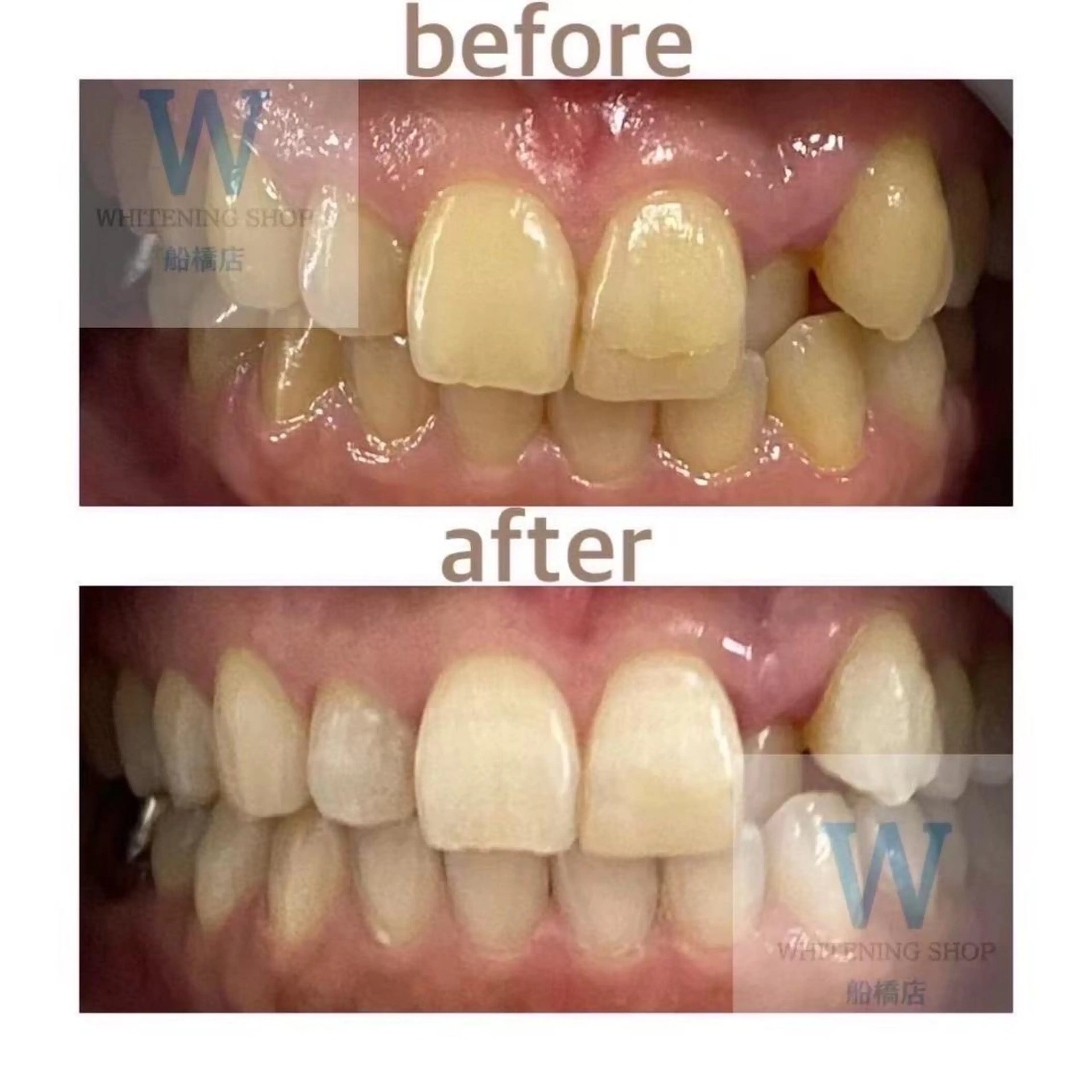 ホワイトニング ショップ船橋２号店のエステ・リラクイメージ