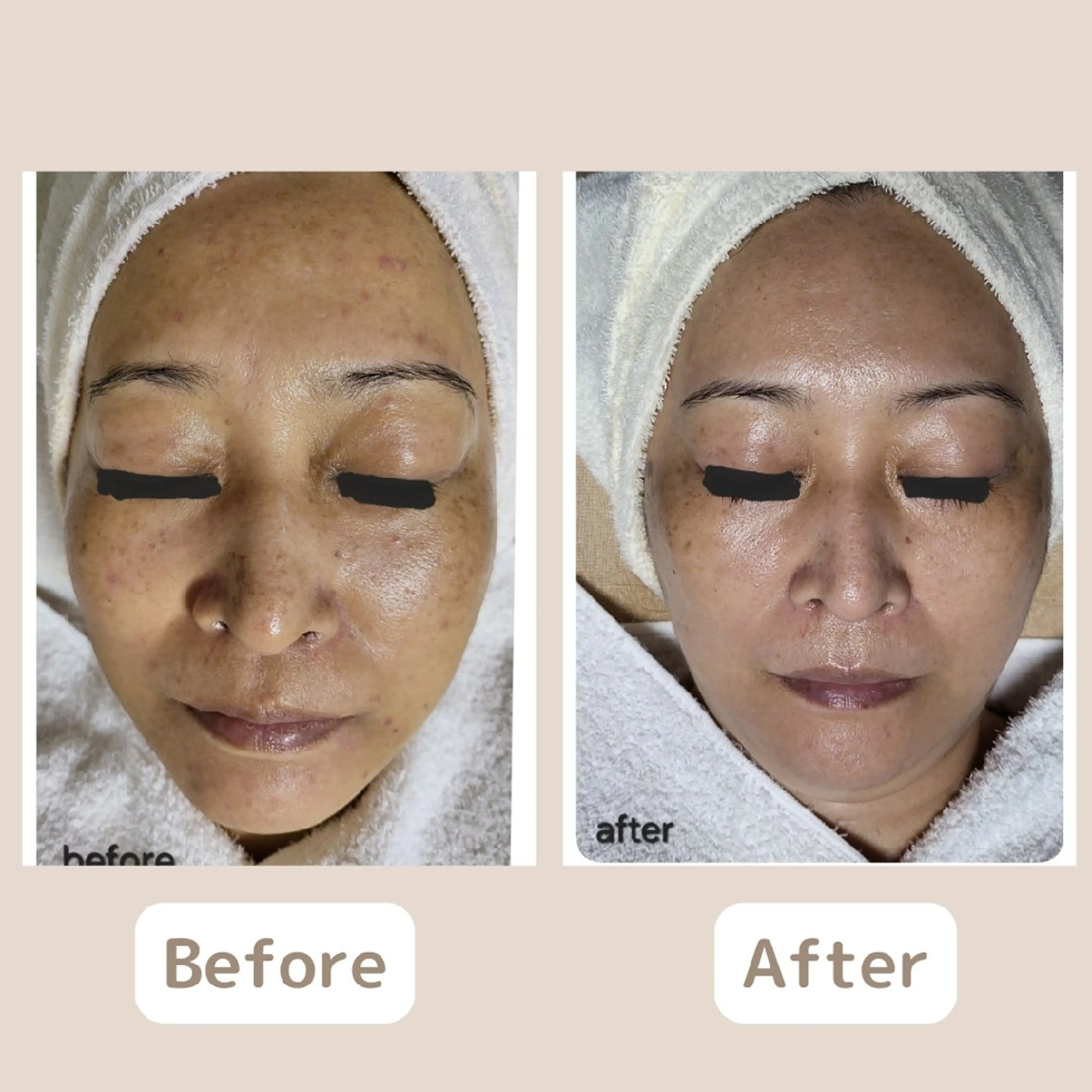 〈ニキビケアサロン〉 レゾン京橋店/ 浅川のエステ・リラクイメージ