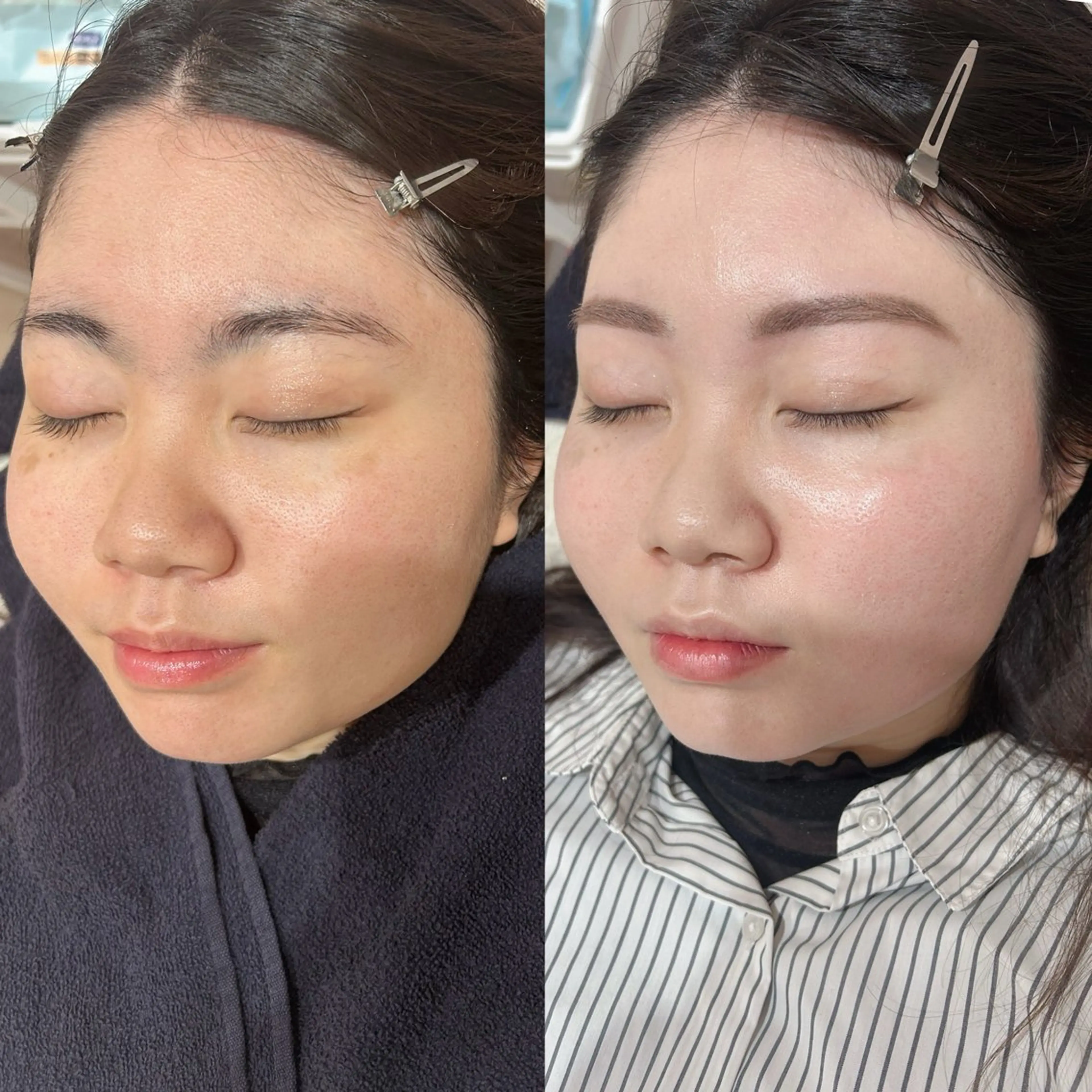 アイブロウ 藤田 音乃のエステ・リラクイメージ