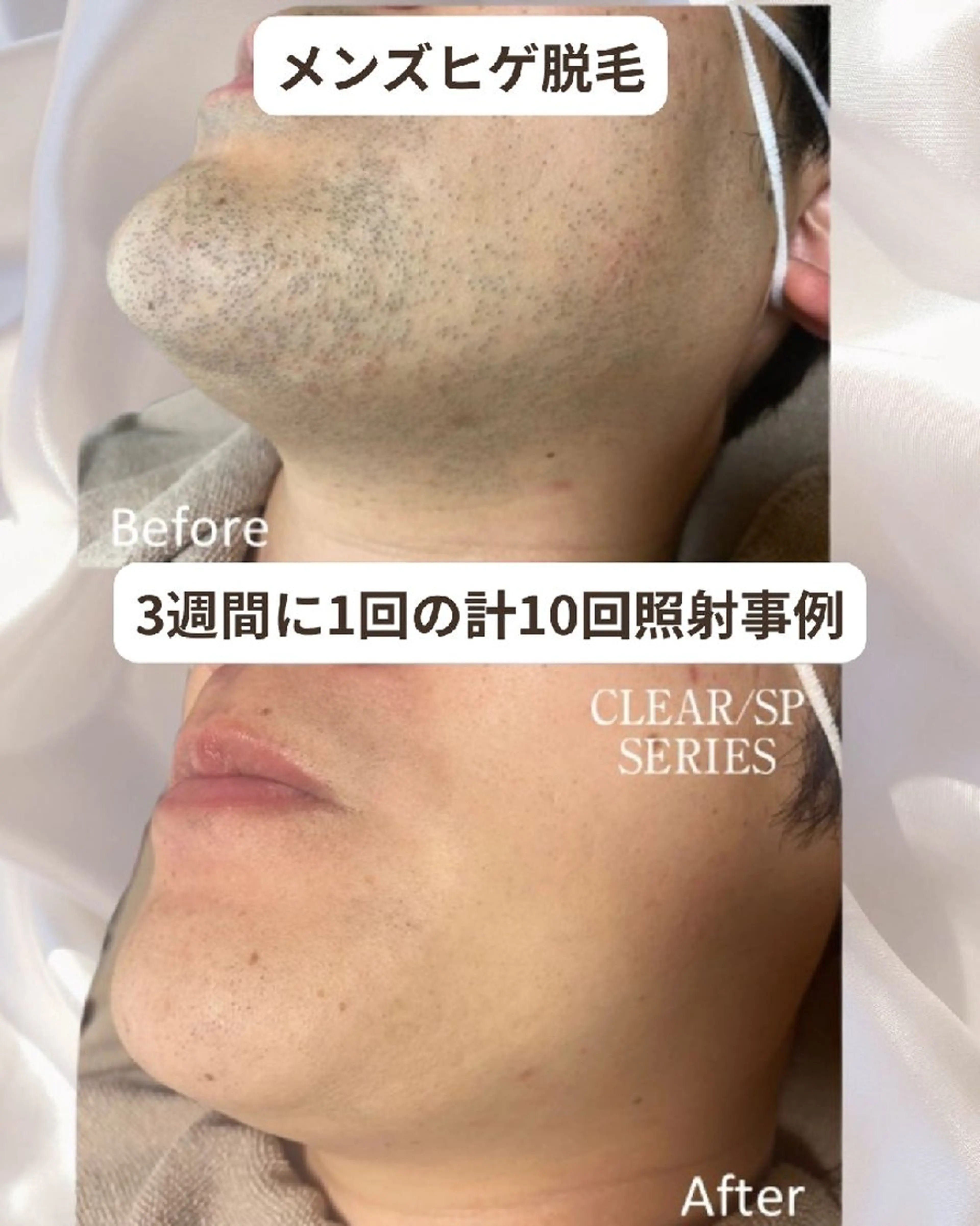 メンズ 脱毛 Maum SkinSalonのエステ・リラクイメージ