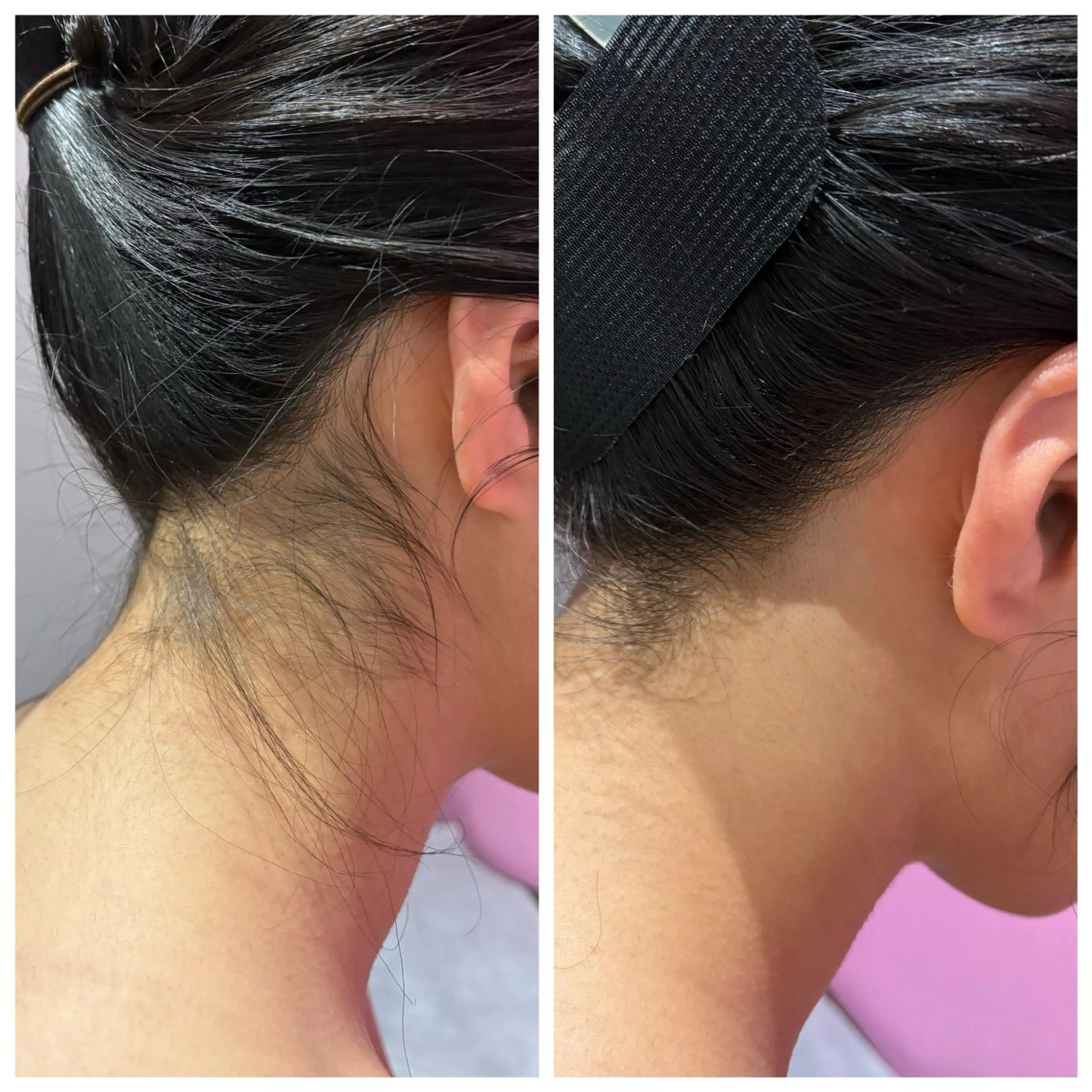 脱毛 A"-HILU （アーヒル)のエステ・リラクイメージ