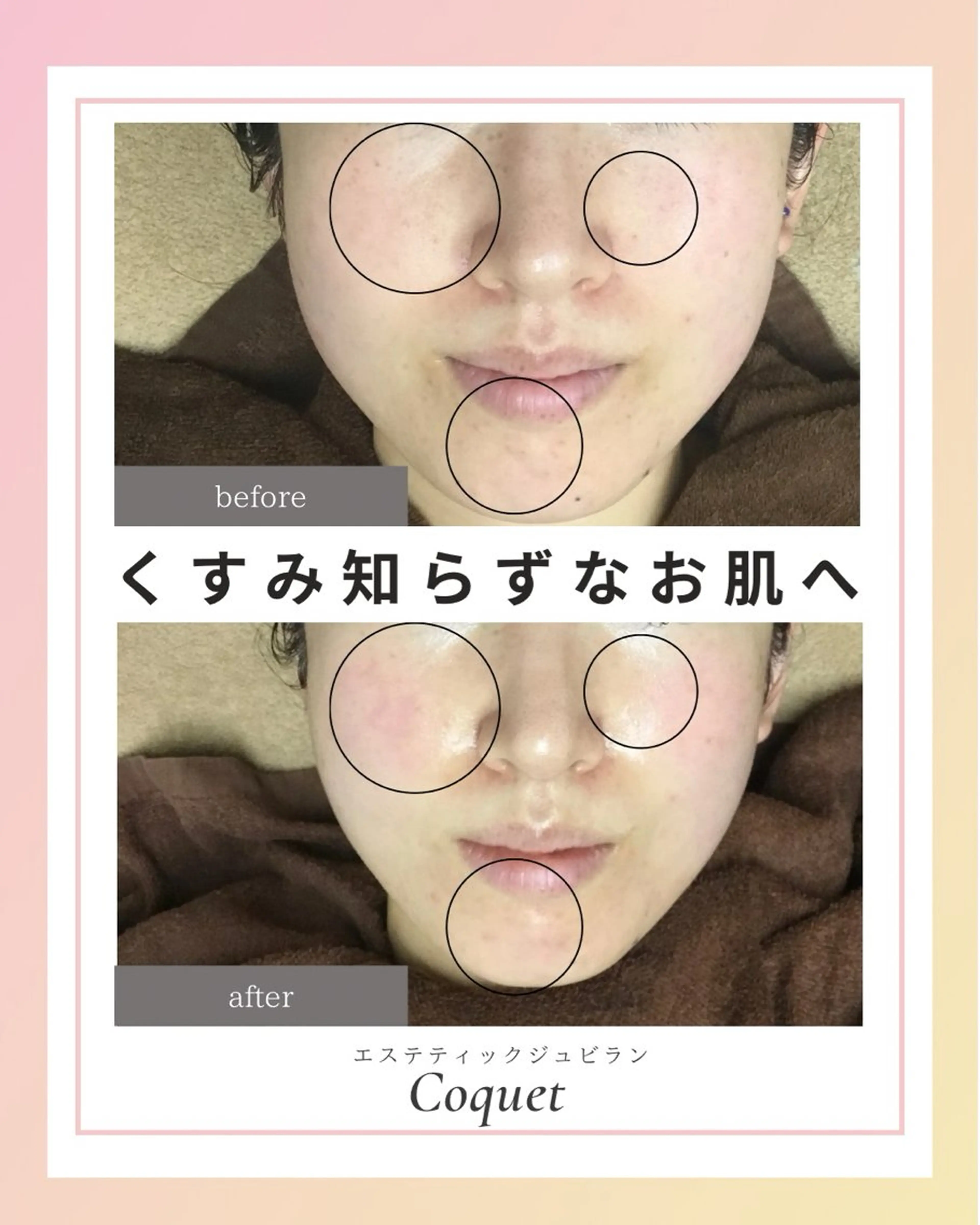 ジュビラン Coquetスタッフのエステ・リラクイメージ