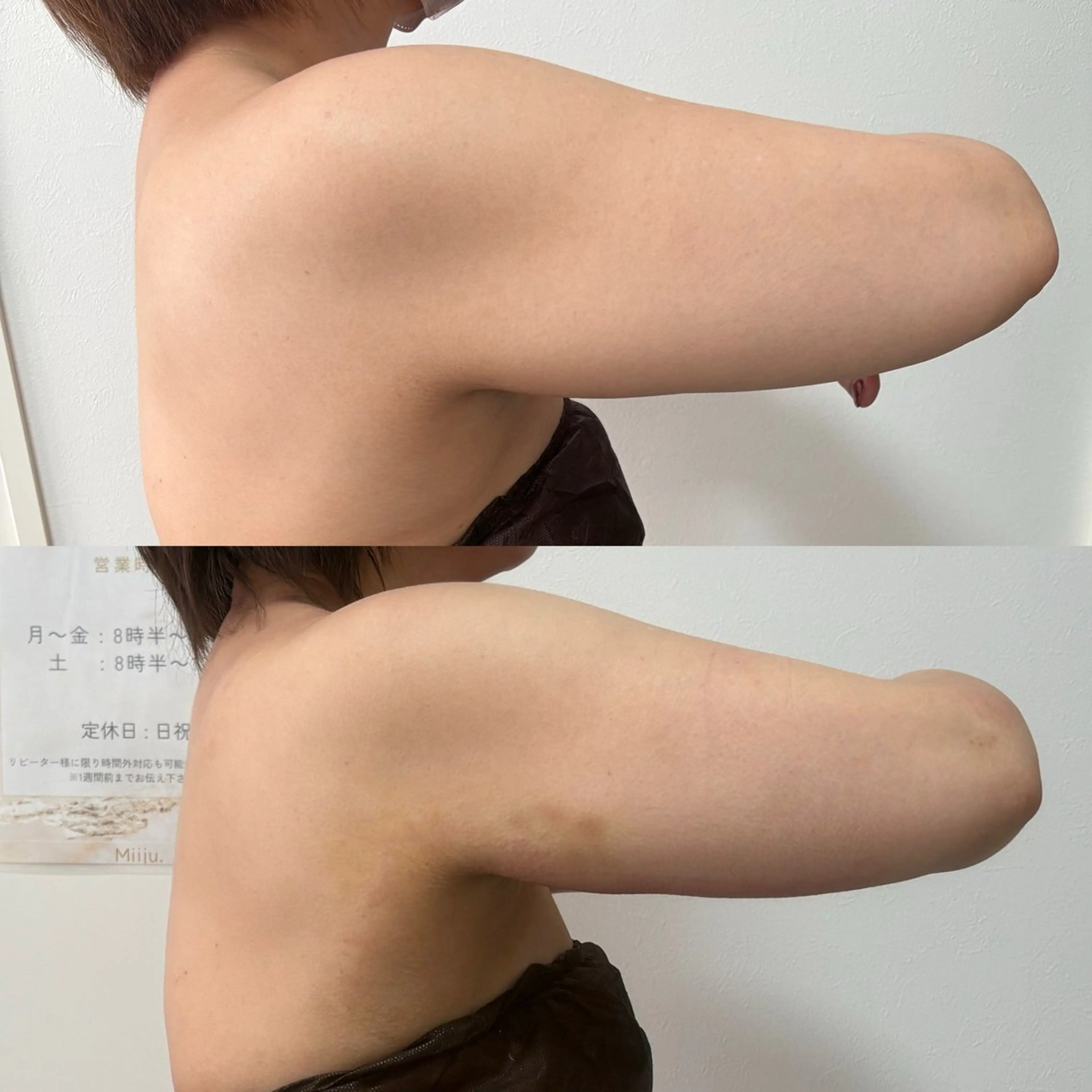 エステ 石巻 冷却痩身 Miiju. 鈴木のエステ・リラクイメージ