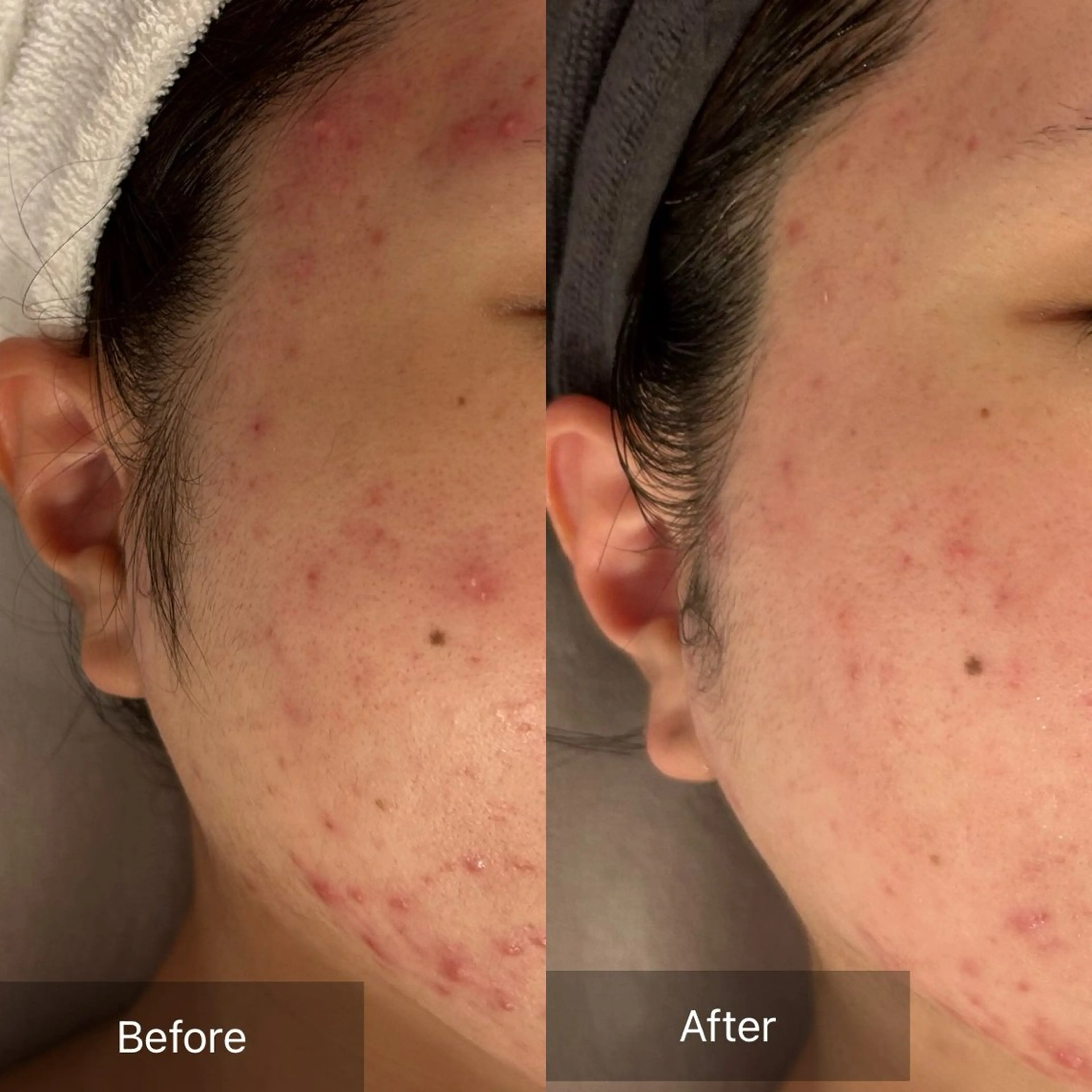 mine.mi マインエムのエステ・リラクイメージ