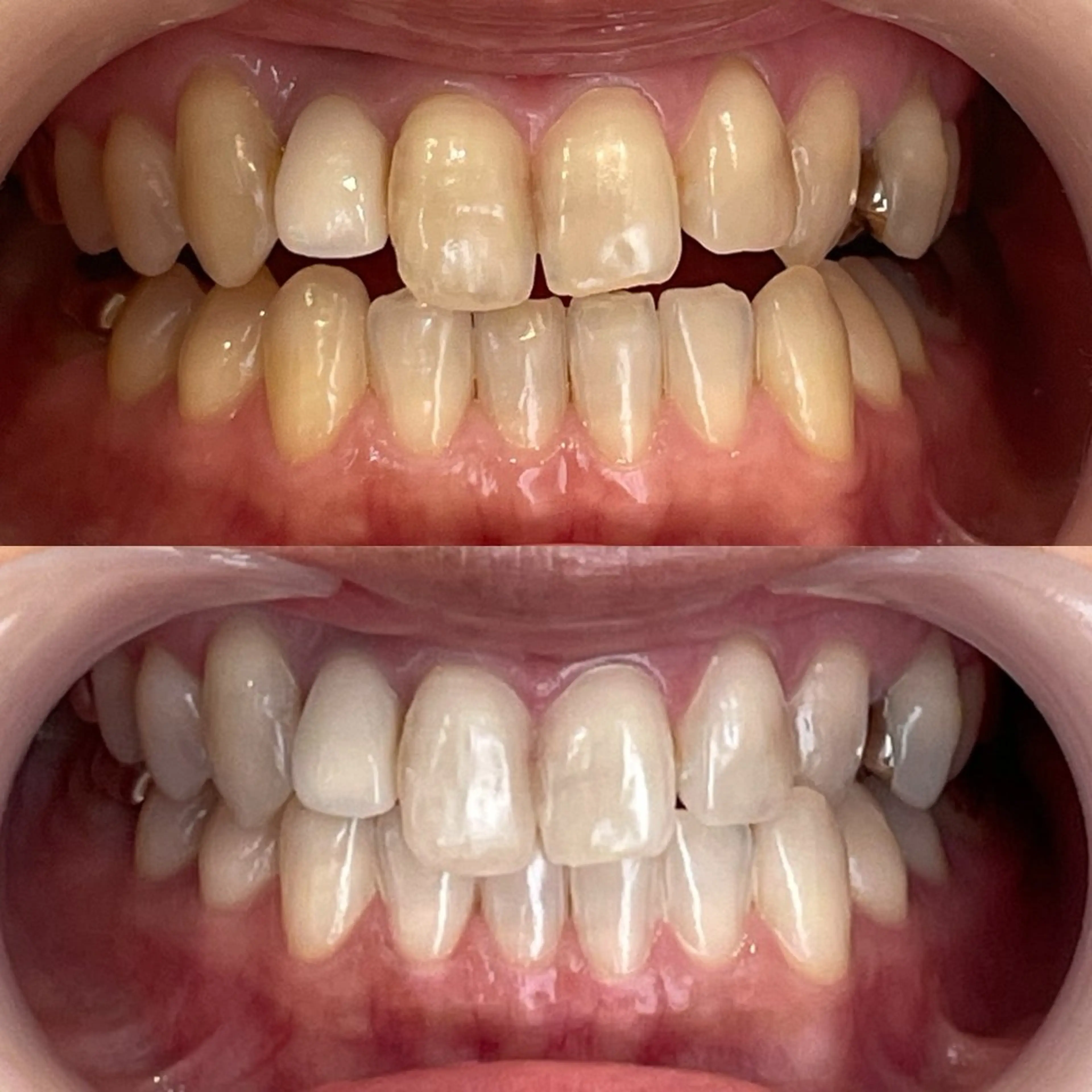 ホワイトニングサロンライエ所属・岡本 由香理のその他イメージ