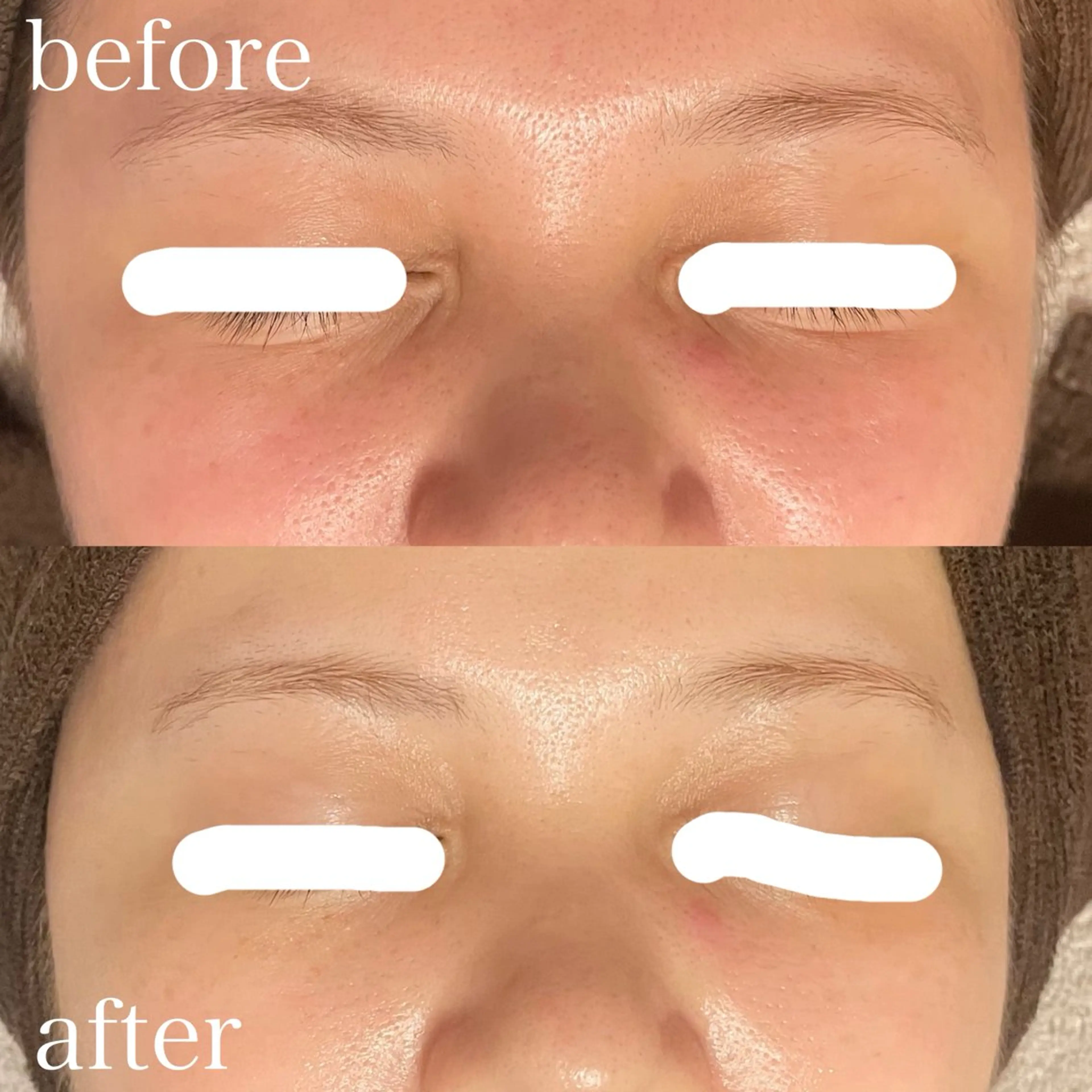 フェイシャル専門店 regaloのエステ・リラクイメージ