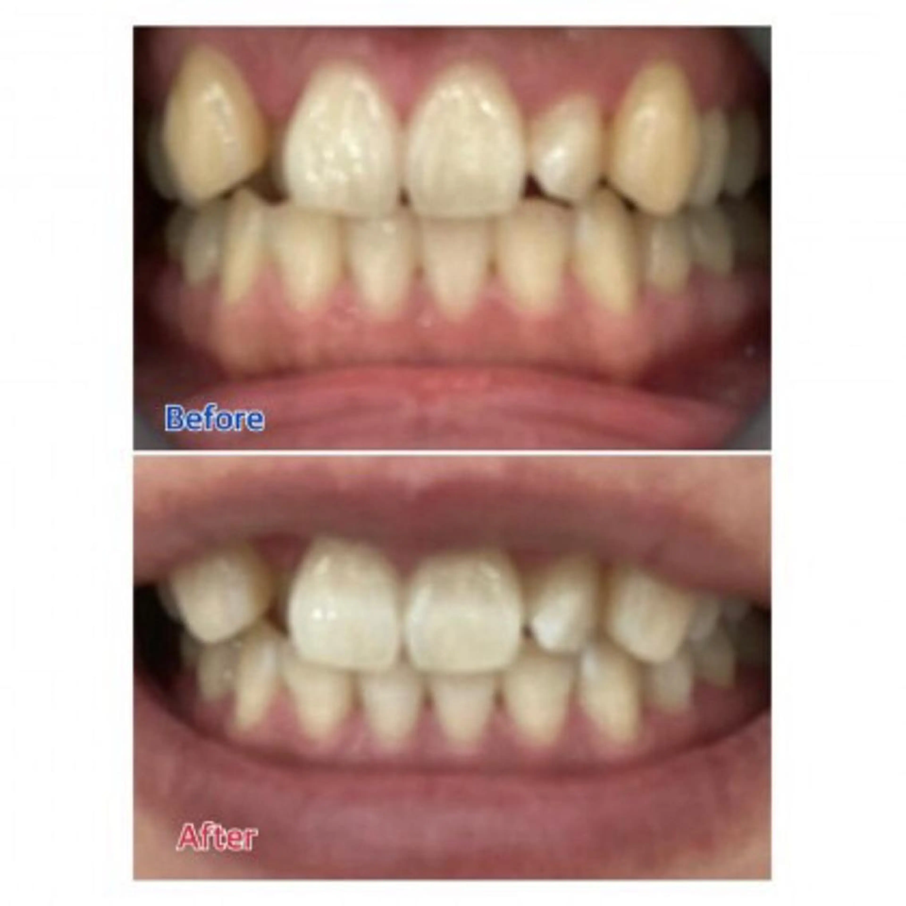 Ｍ渋谷 ホワイトニングのエステ・リラクイメージ