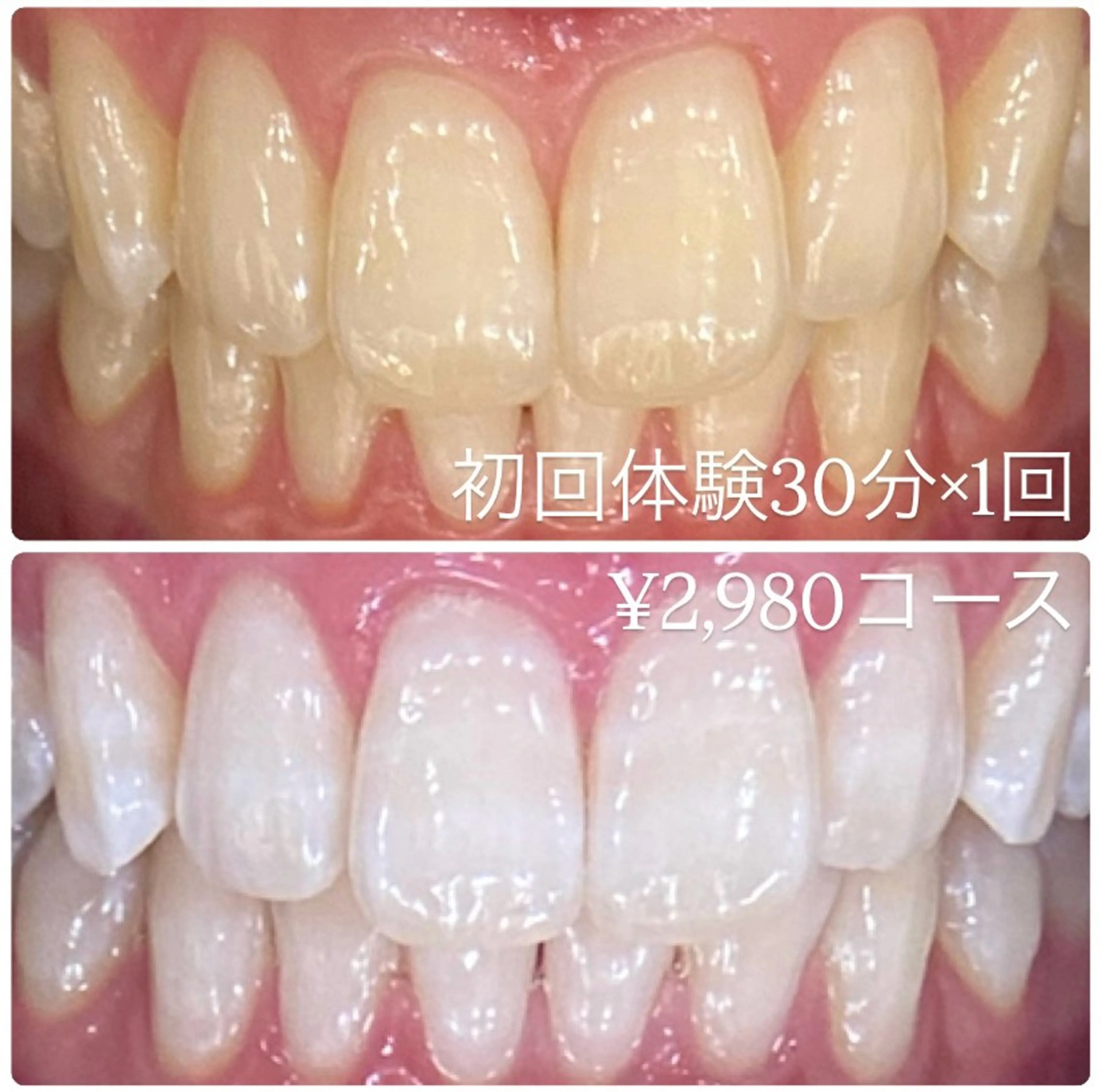 ホワイトニングルーム 横浜店のその他イメージ