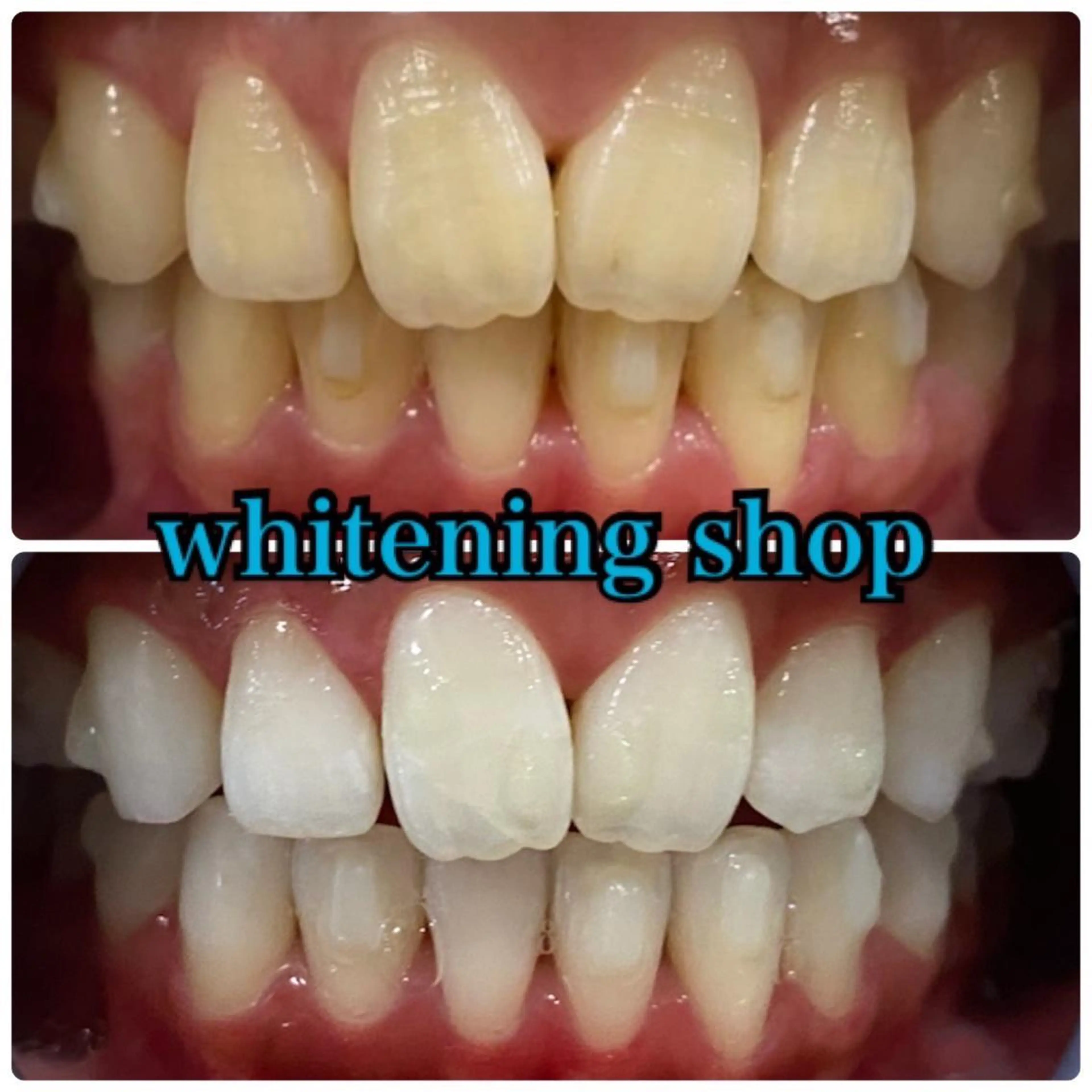 その他 ホワイトニング ショップ千葉店のその他イメージ