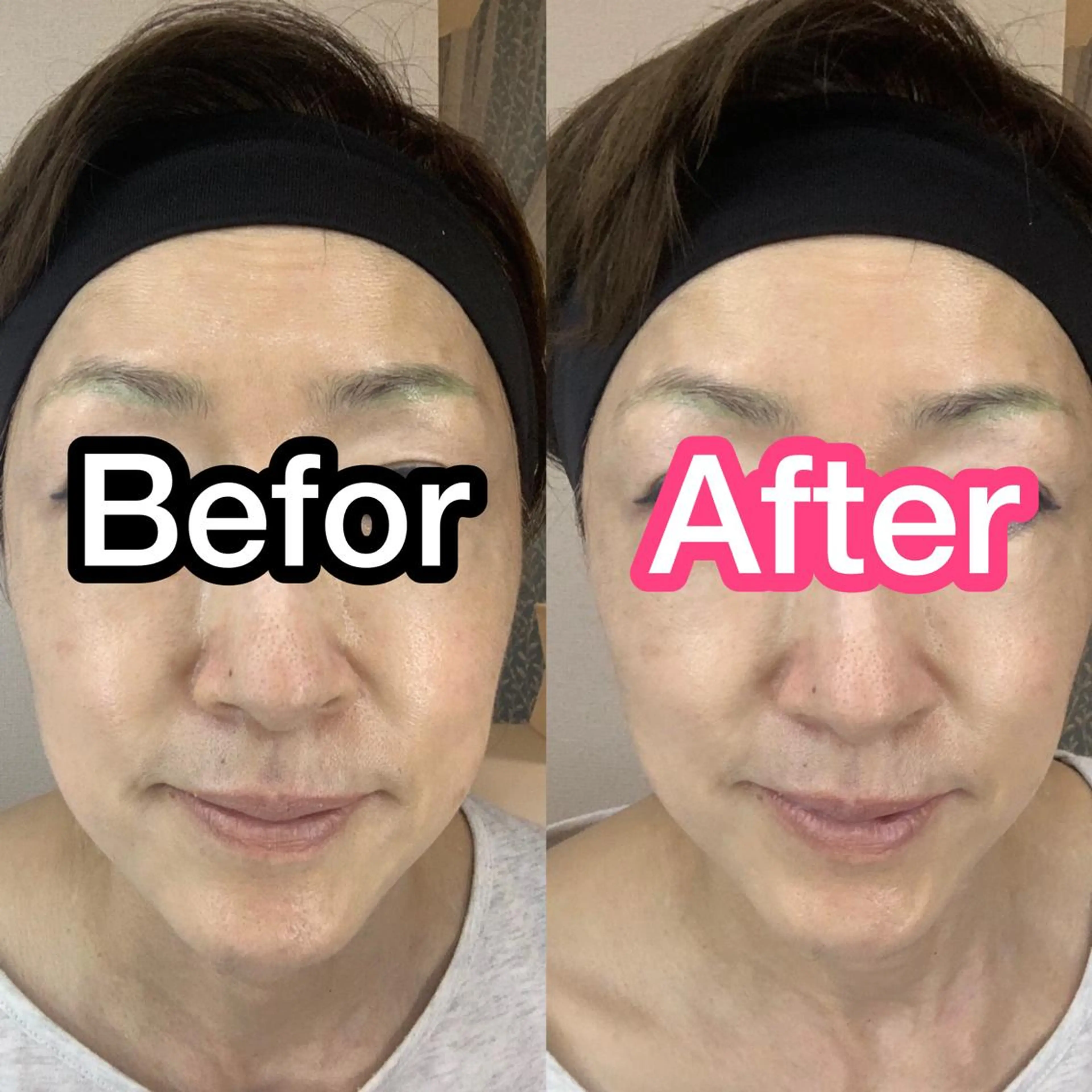 プラチナムビューティー柏所属・【歯科提携】柏ホワイ トニングスタイルのその他イメージ