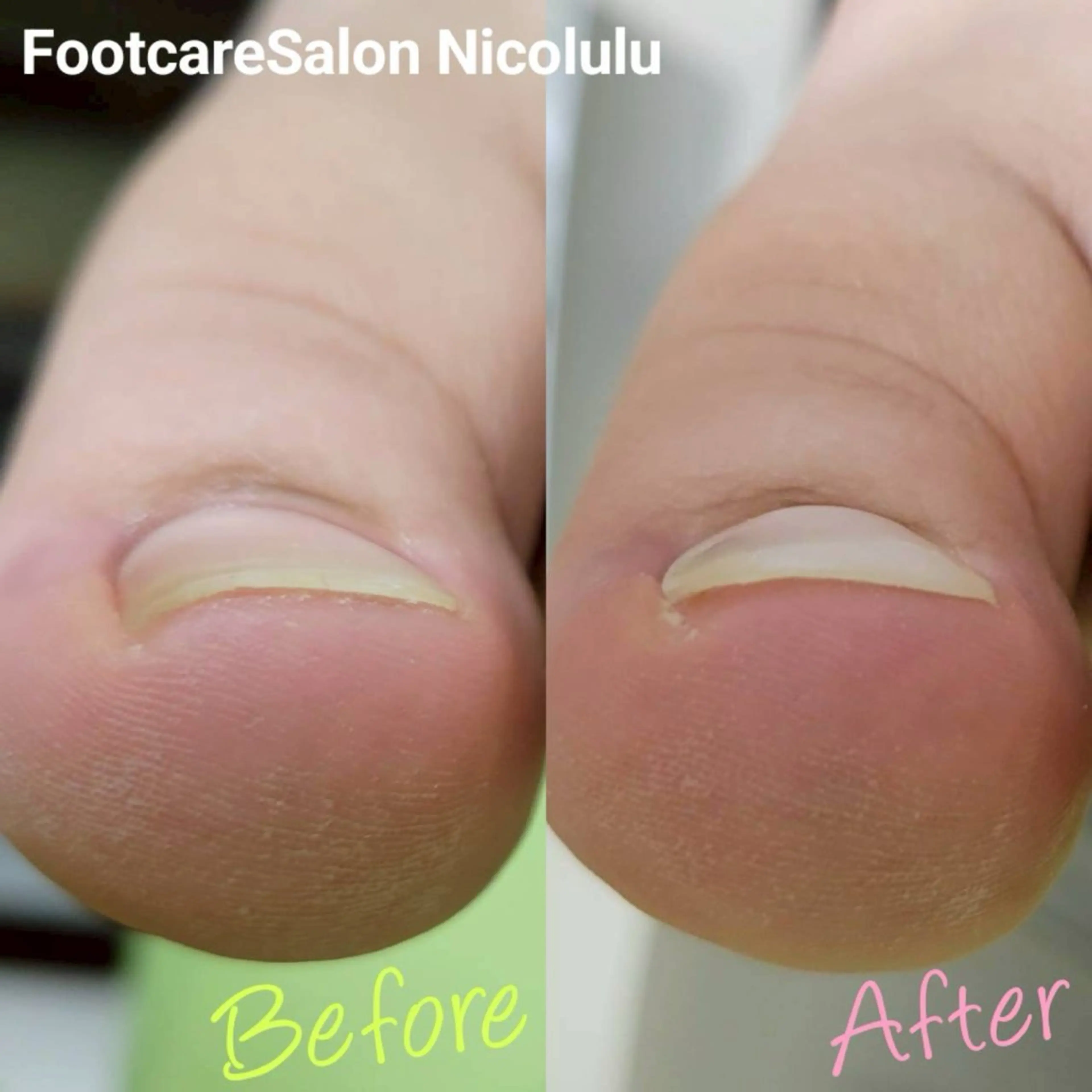 リラク 足トラブル専門 ニコルル金沢のエステ・リラクイメージ