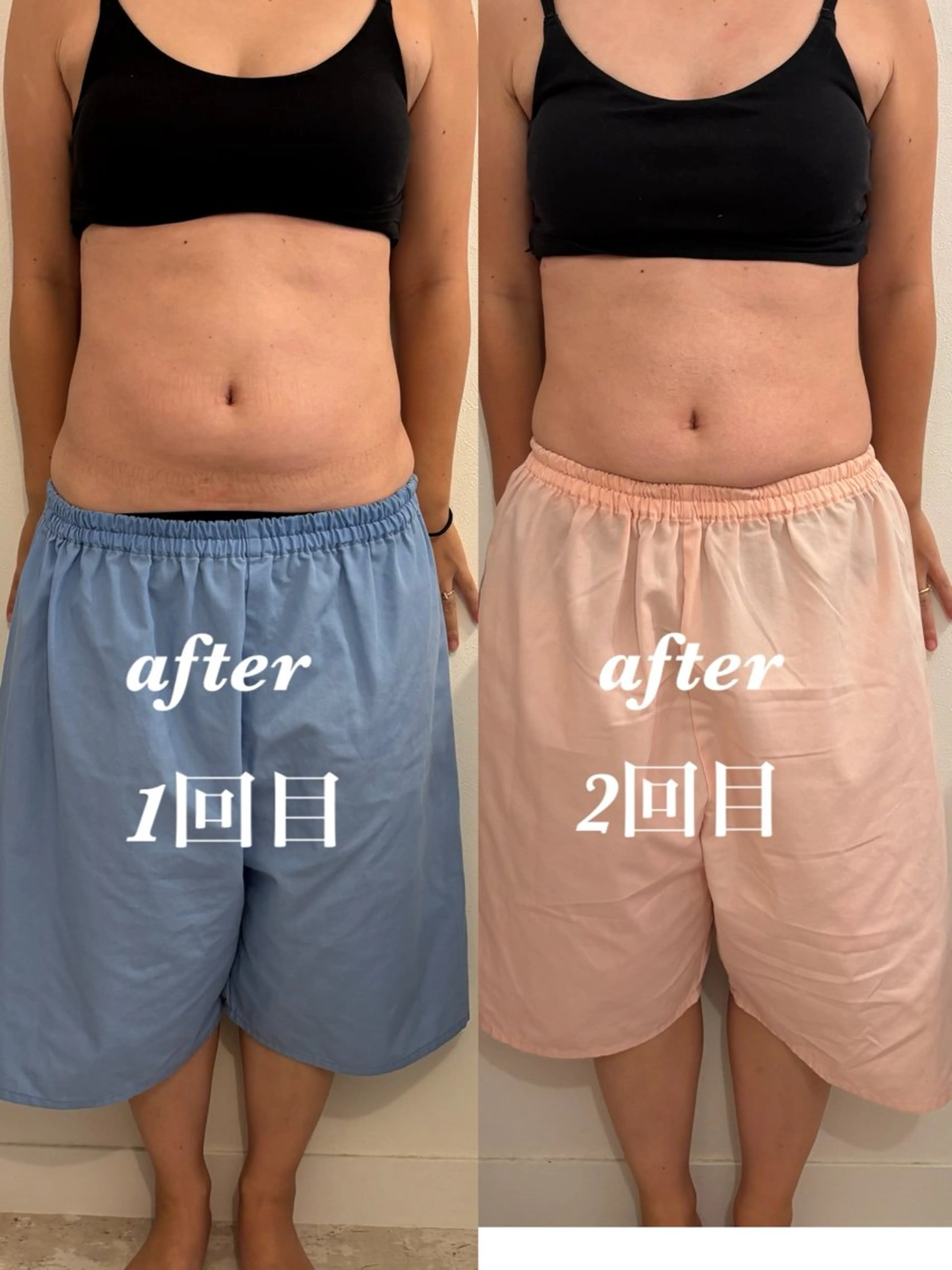 その他 腸活サポート みなみののエステ・リラクイメージ