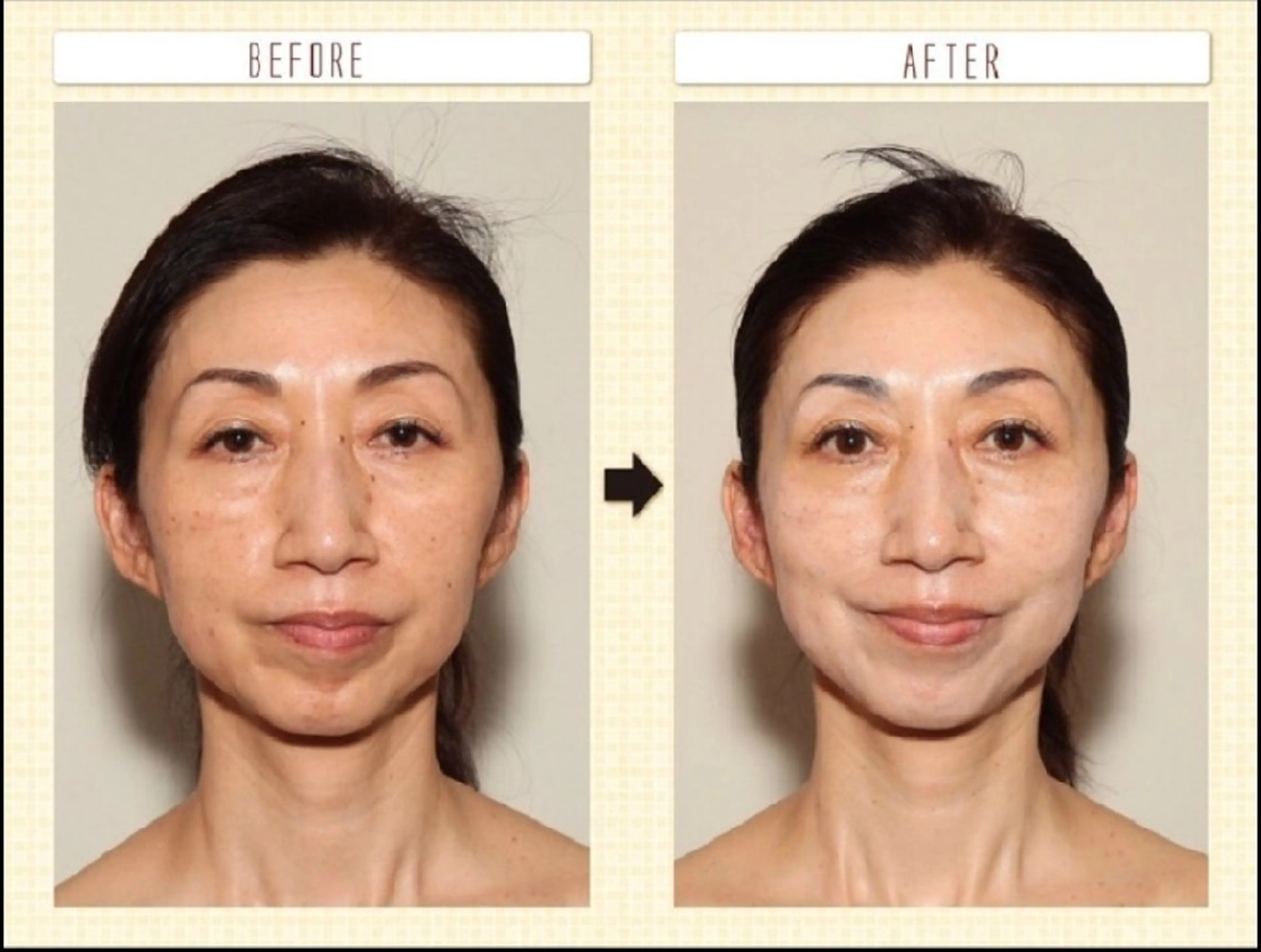 エステ 辻村 晴美のエステ・リラクイメージ