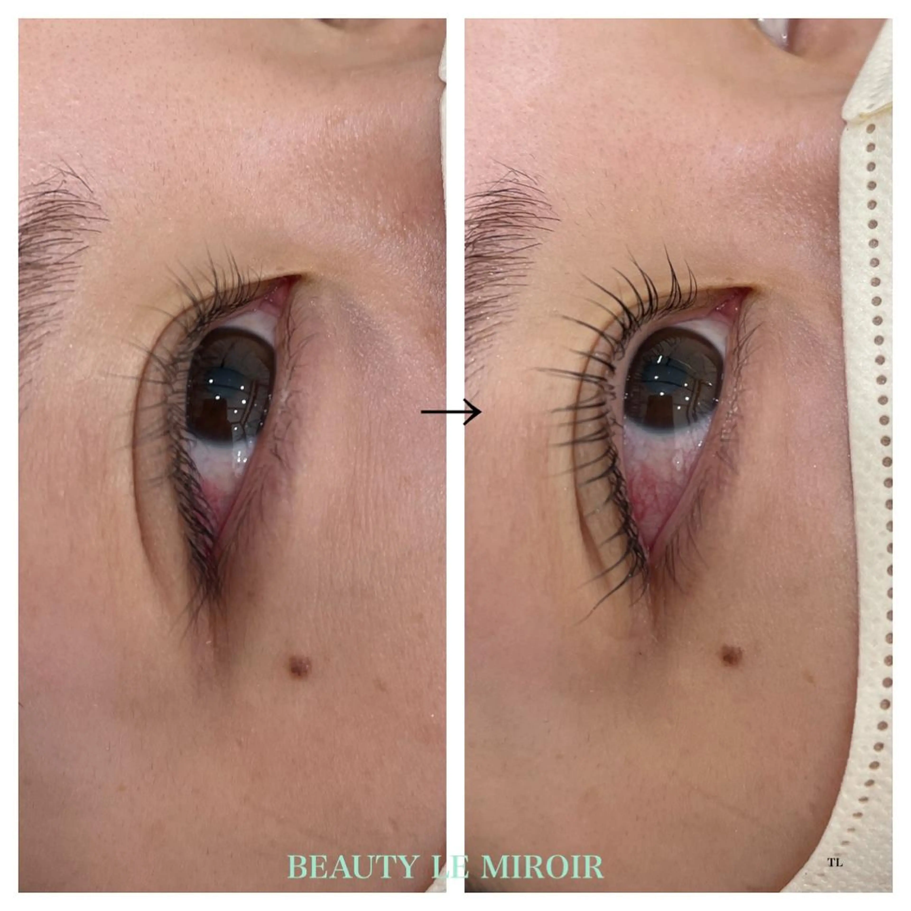 マツエク・マツパ ビューティー ミロワールのエステ・リラクイメージ