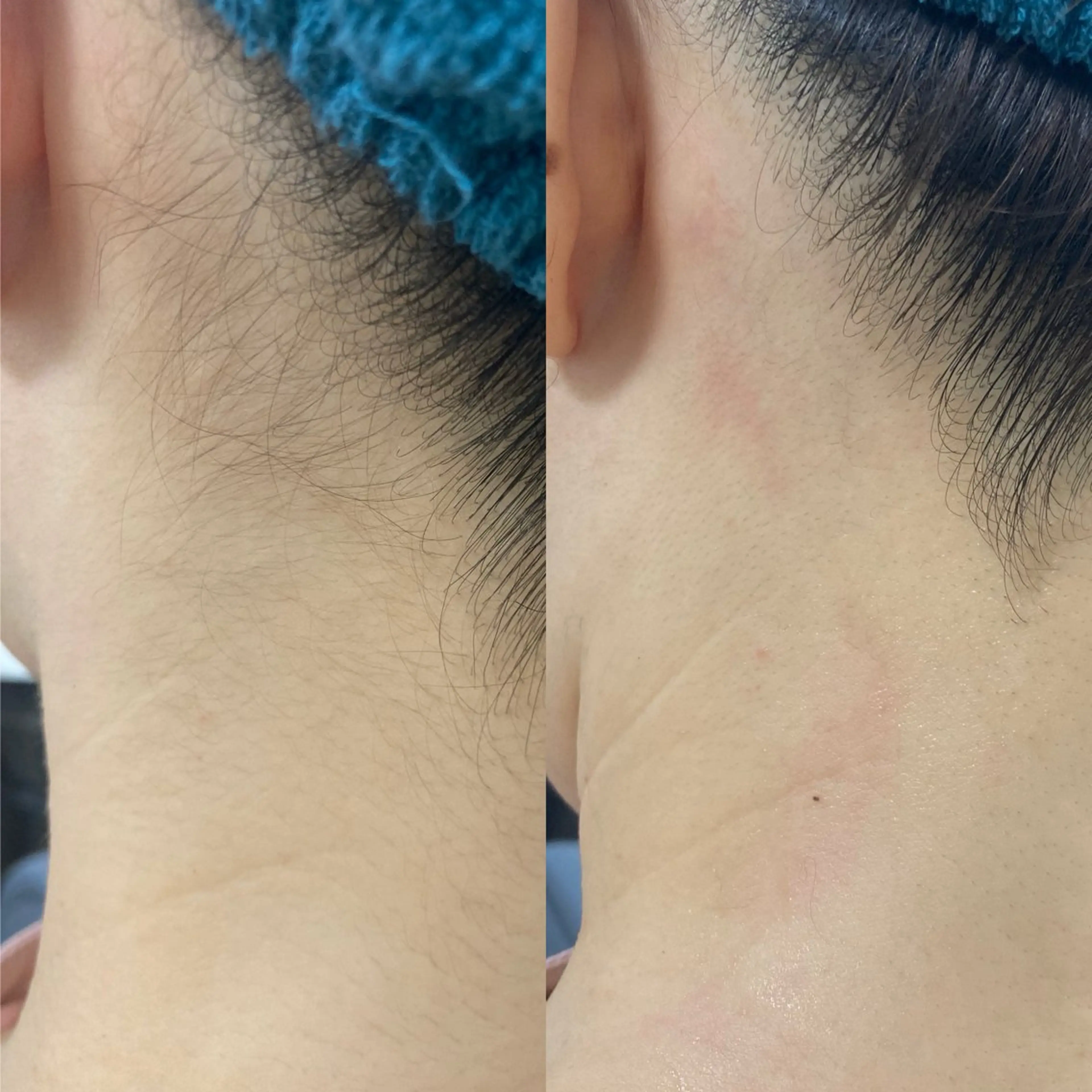 脱毛 サロン結所属・谷口 多枝子のエステ・リラクイメージ