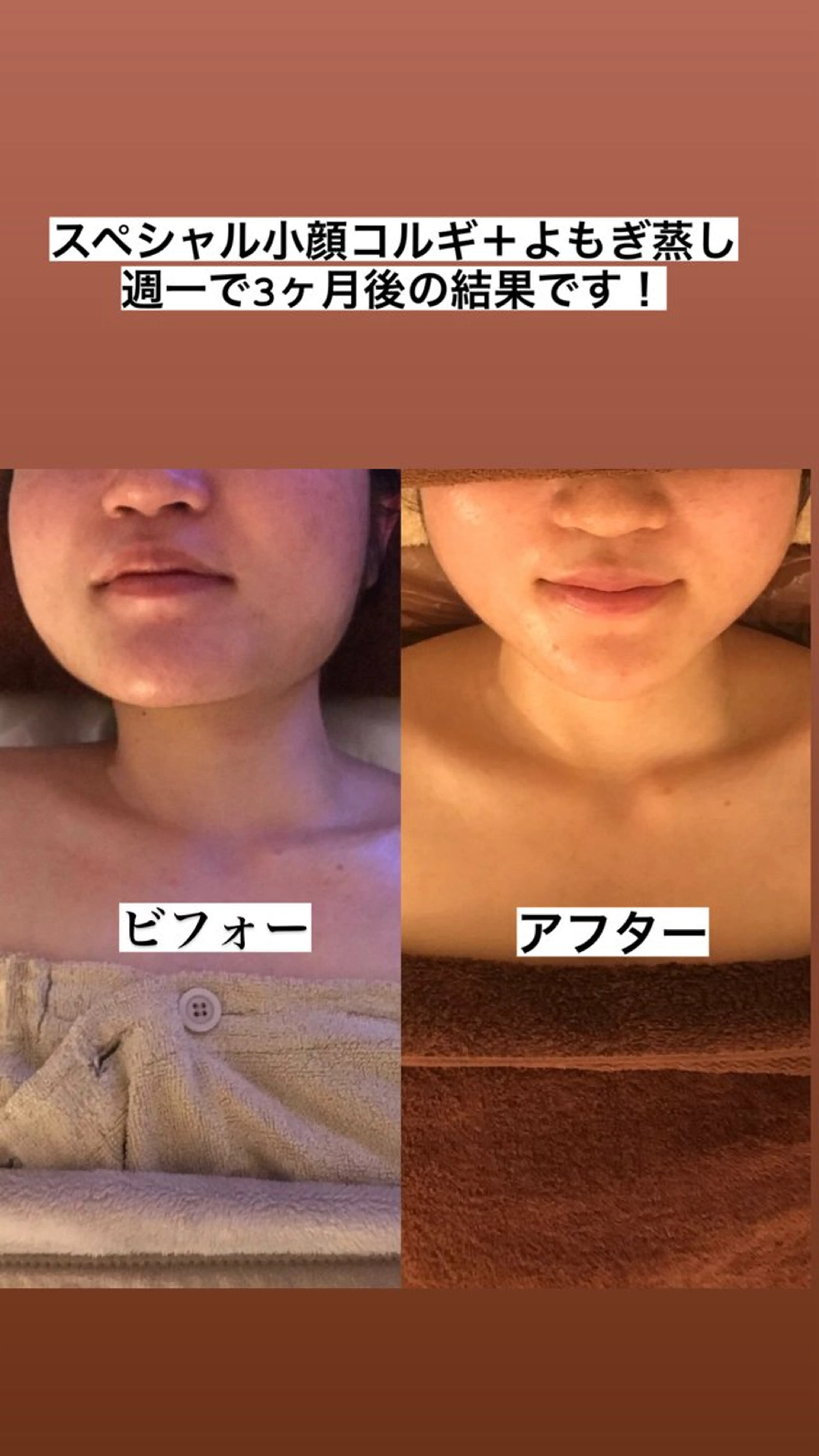 エステ リラク 小顔コルギ&よもぎ蒸しサロンLINKA所属・小顔&美肌 サロンLINKAのエステ・リラクイメージ