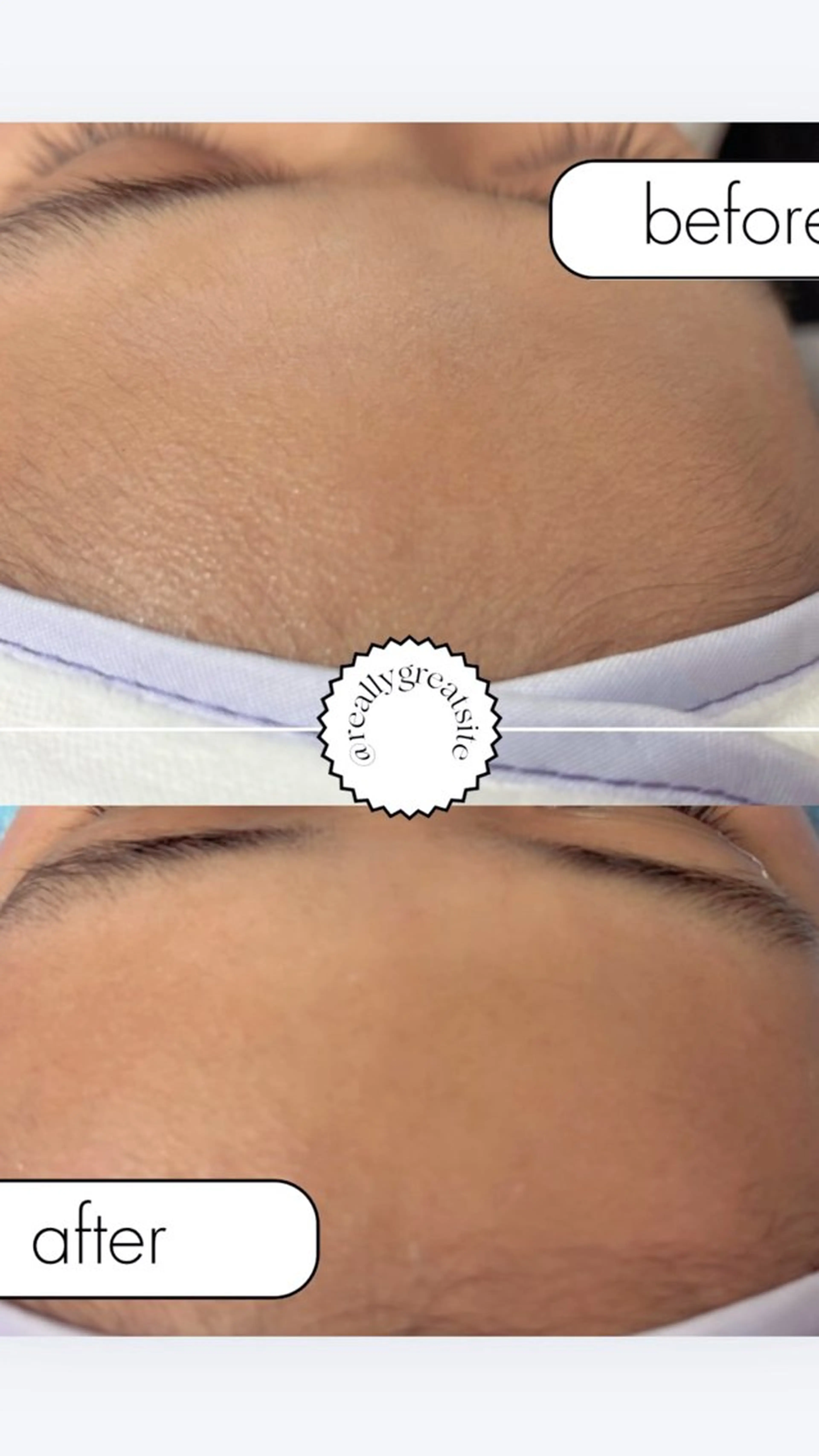 フェイシャルワックス　24時間保湿パック付きの写真