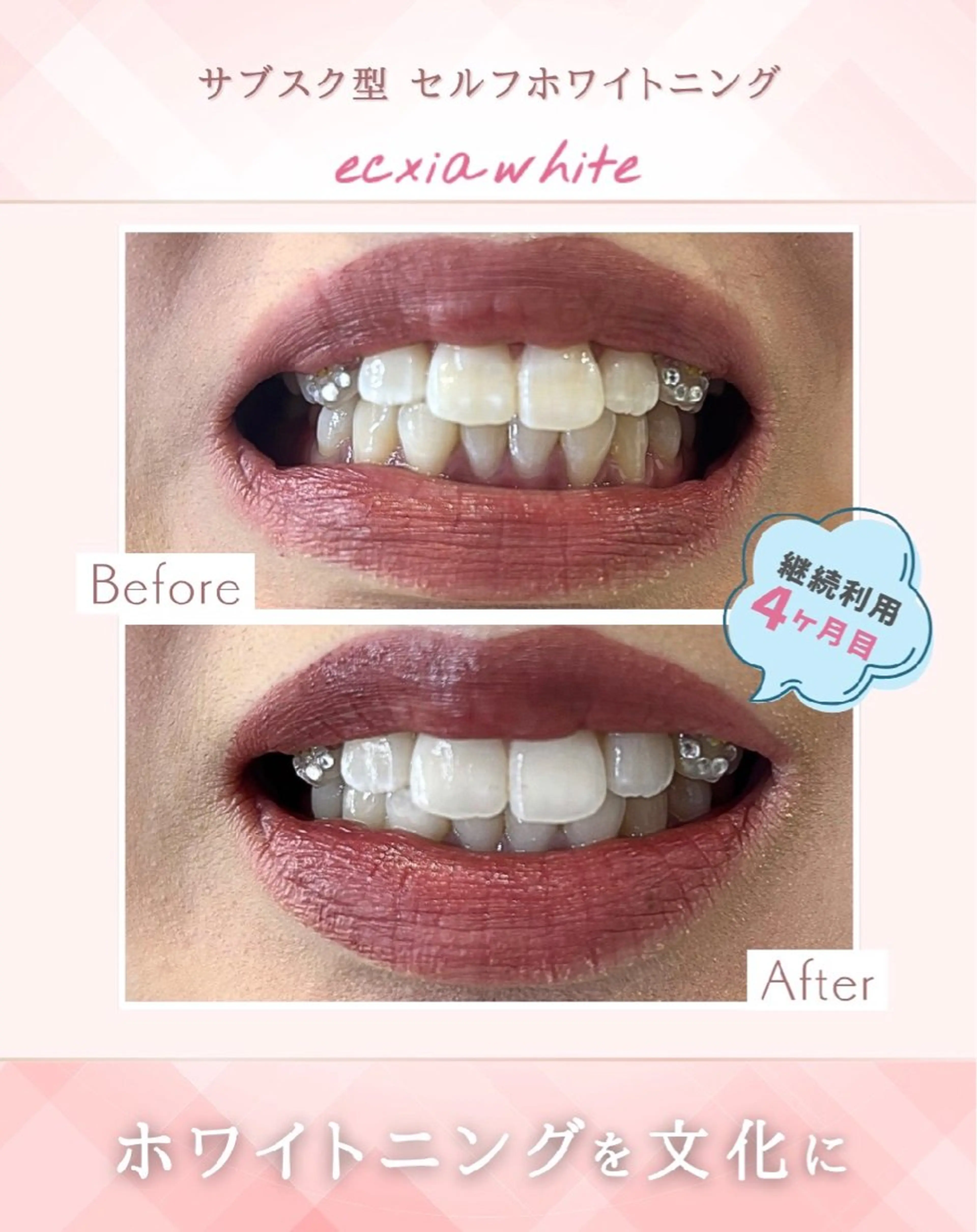 エクシアホワイト 立川南口のエステ・リラクイメージ