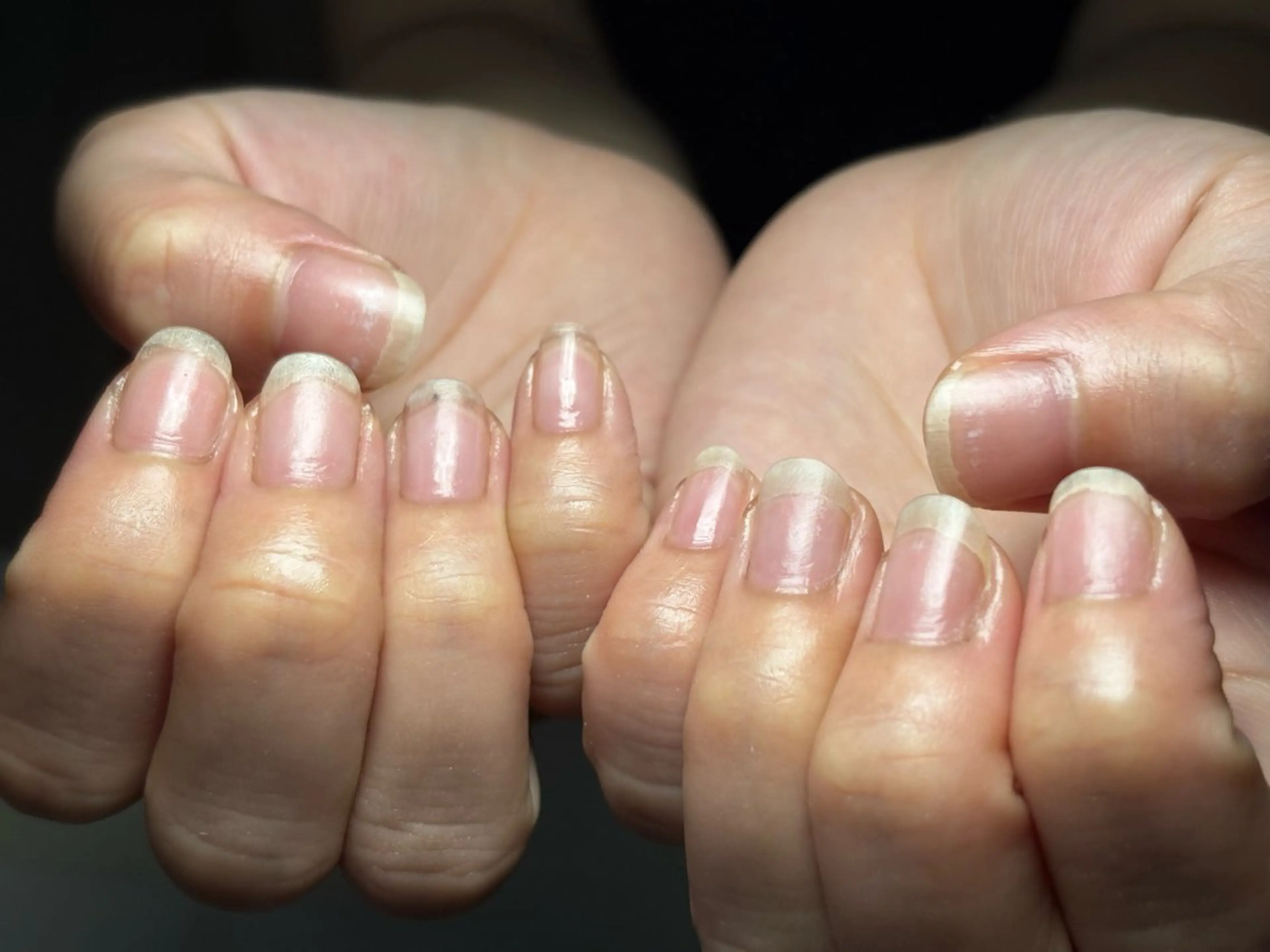 HAND◇オフのみ◇クイックジェルオフ【自店オフ-￥500】の写真