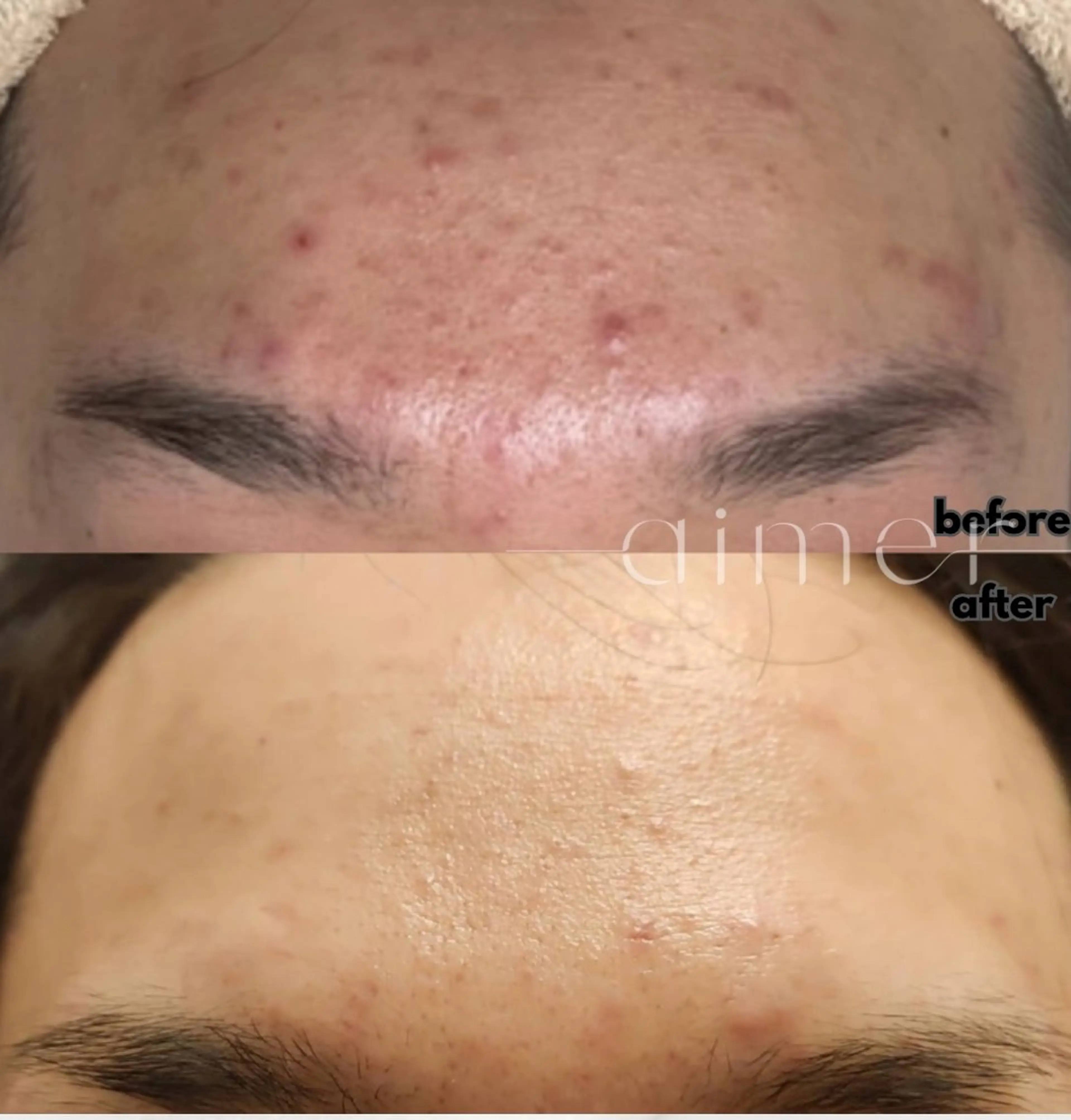 エステ aimer 佐々木のエステ・リラクイメージ