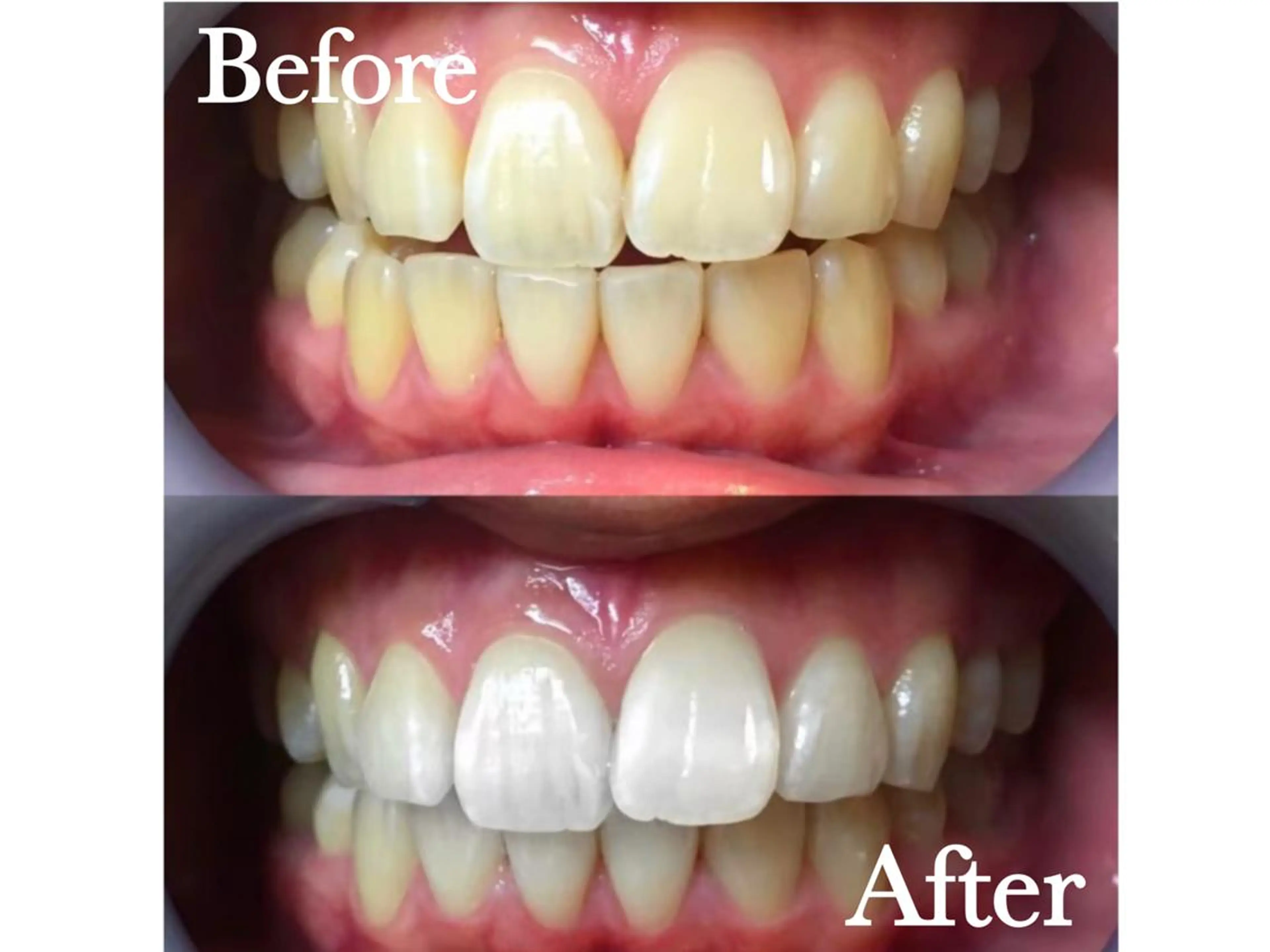 エステ リラク LBSホワイトニング 🌐渋谷店 公式のエステ・リラクイメージ