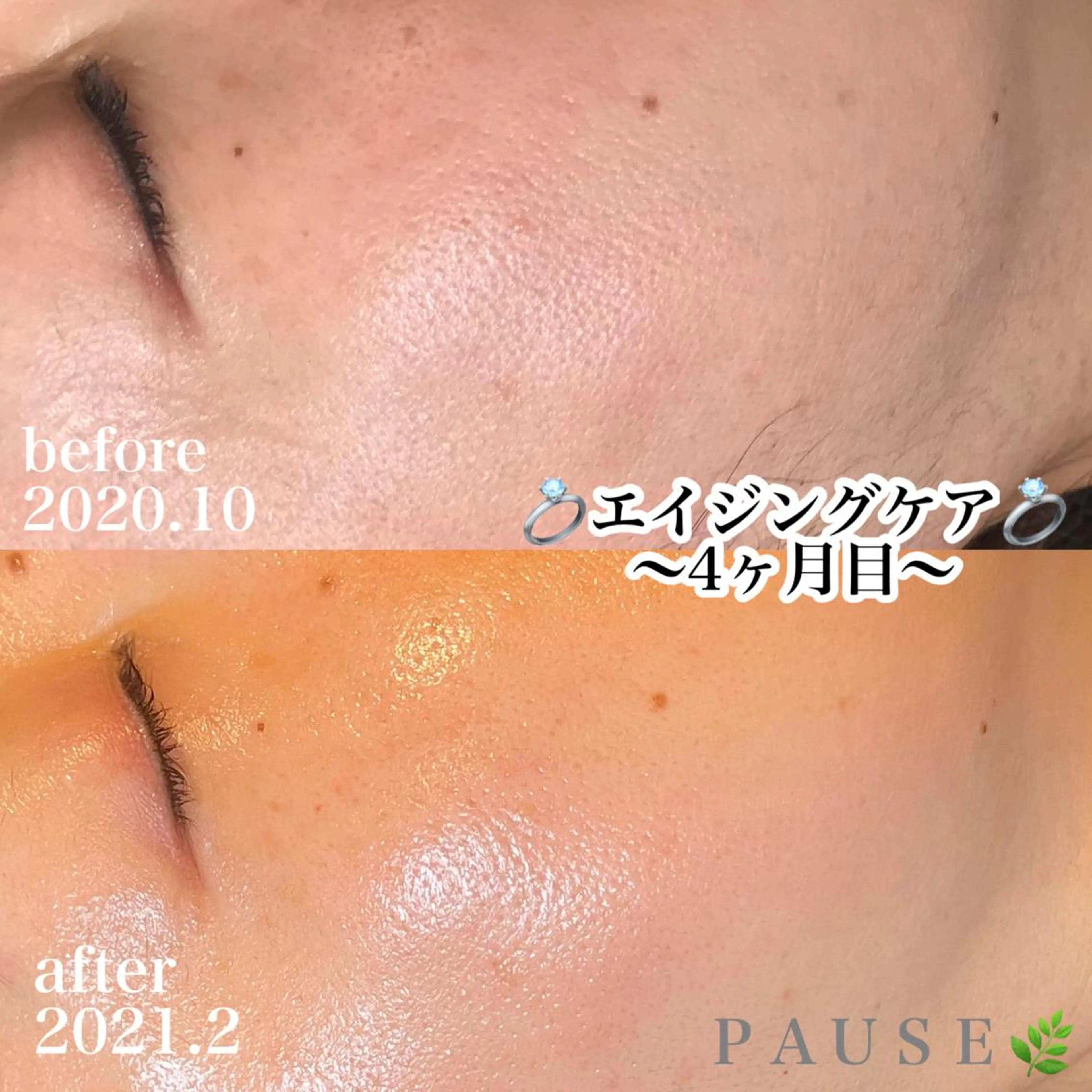 エステ 浜野 恵美のエステ・リラクイメージ