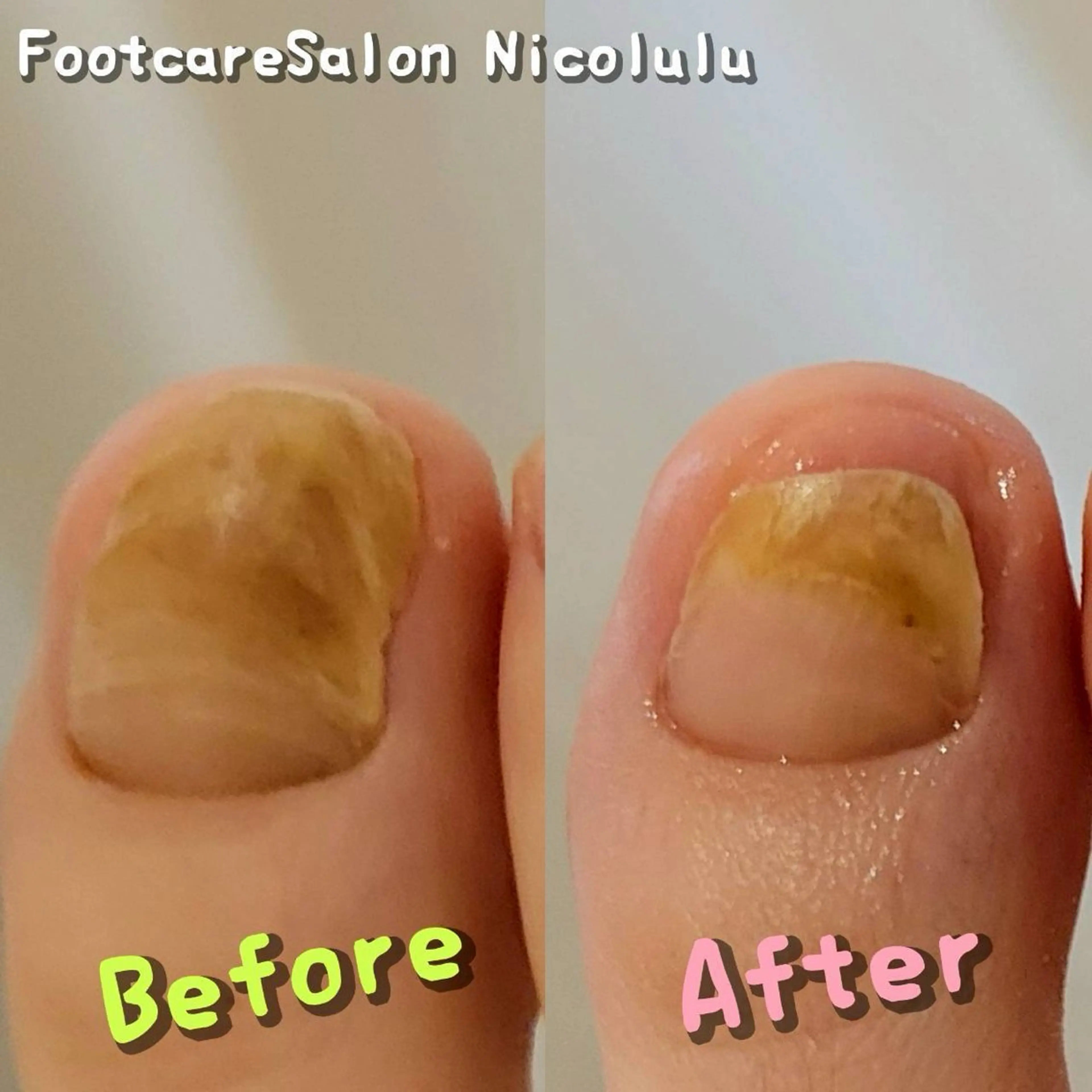 メンズ 足トラブル専門 ニコルル金沢のエステ・リラクイメージ