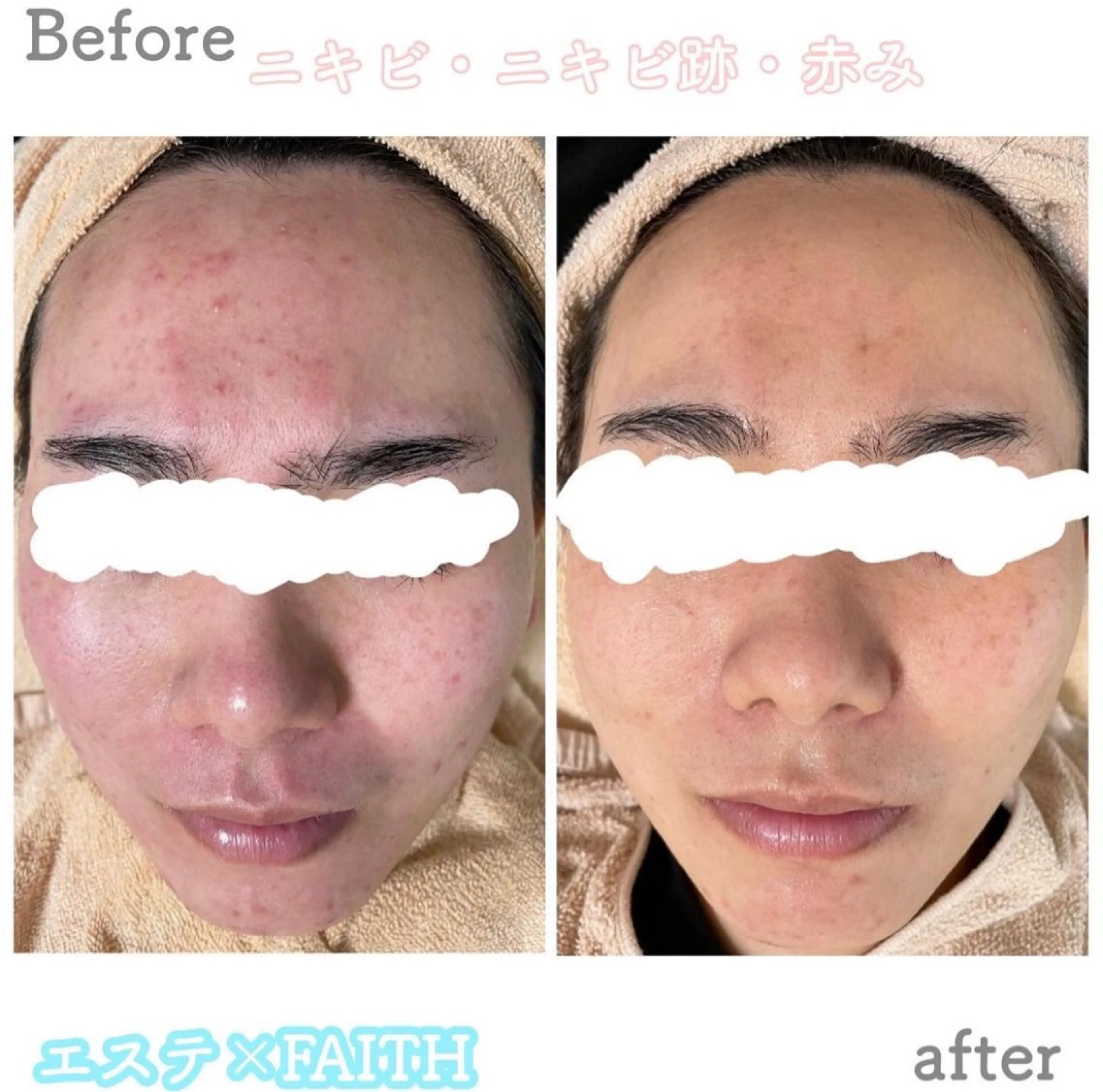 都度払い肌改善専門店 店長二上文香のエステ・リラクイメージ