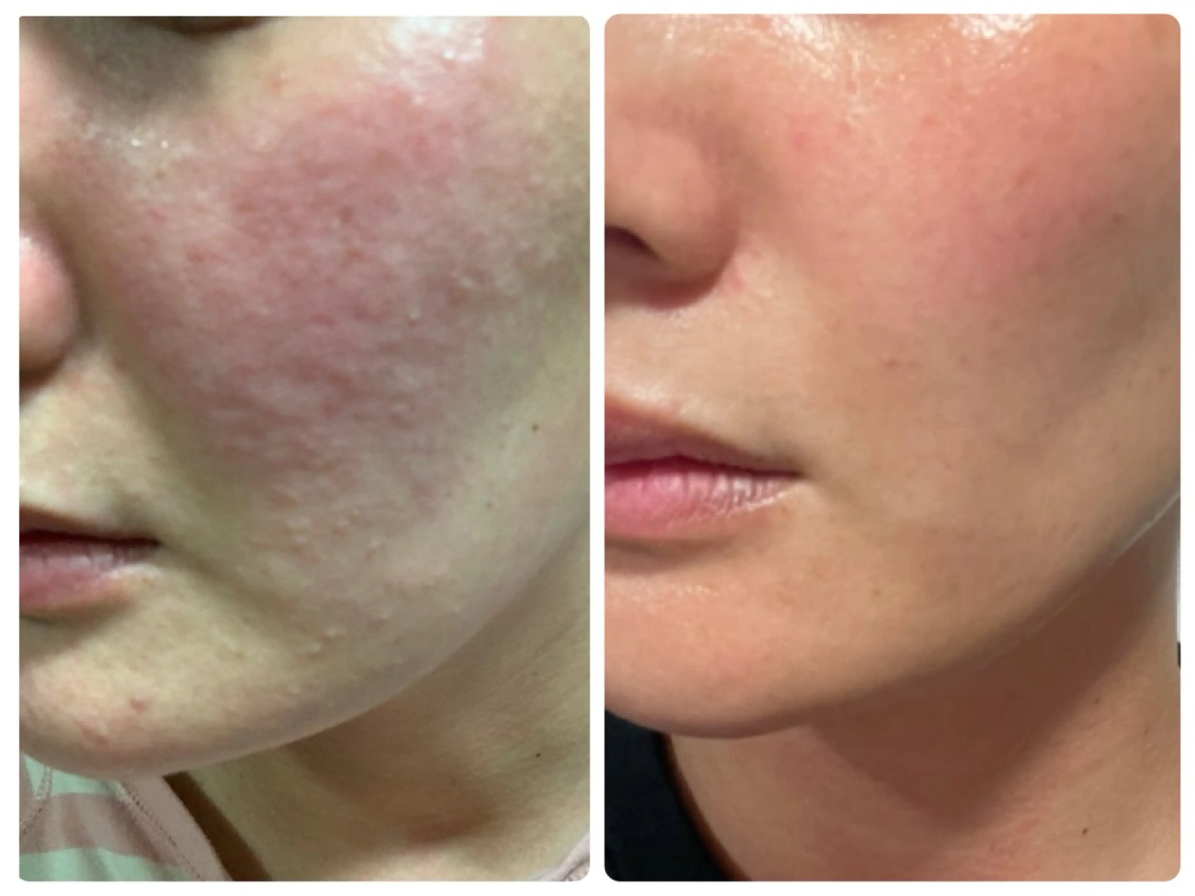 Luce Shokoのエステ・リラクイメージ