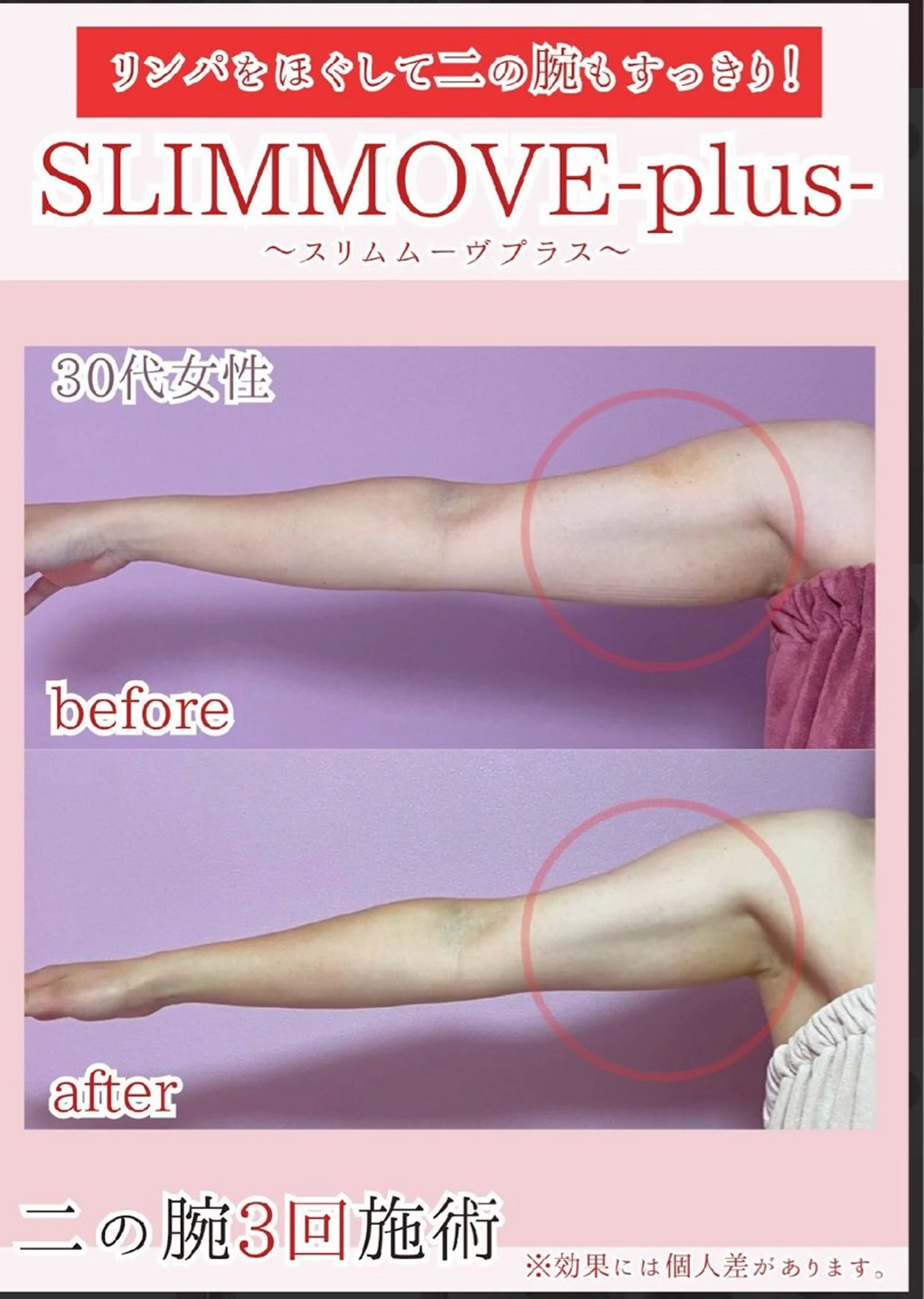 エステ エルモサ痩身脱毛 西八王子店のエステ・リラクイメージ