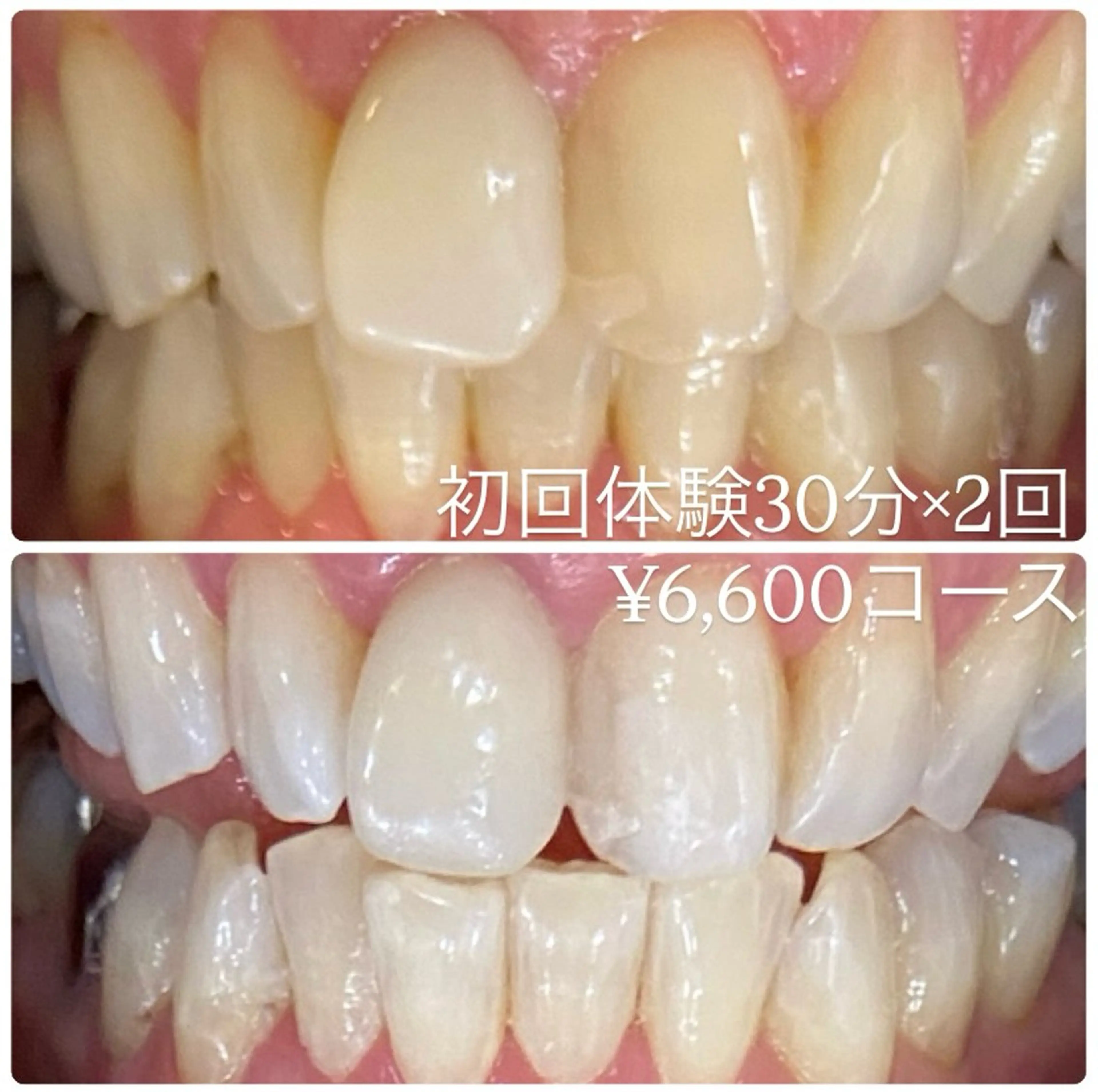 ホワイトニングルーム 横浜店のその他イメージ