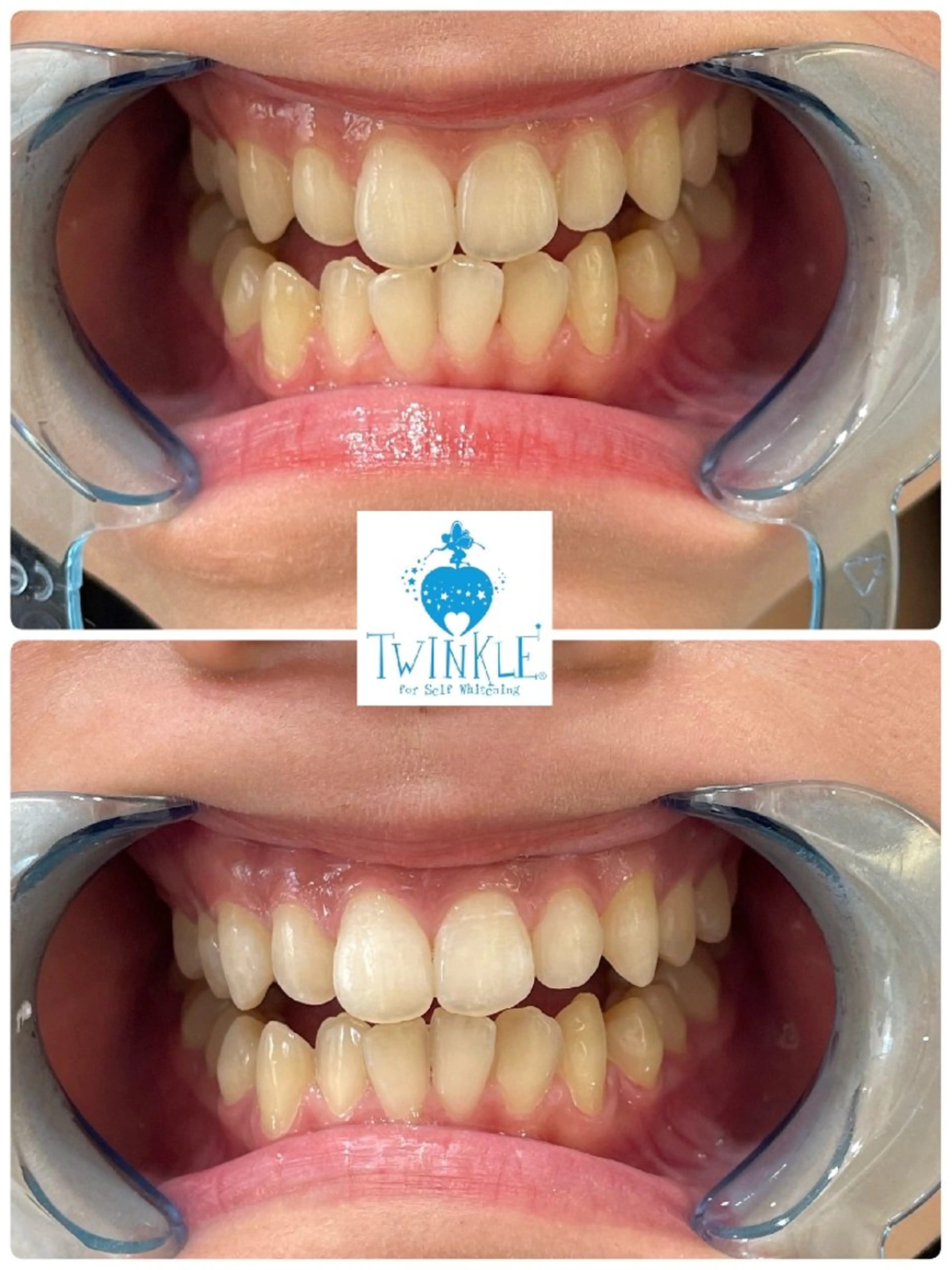 その他 ティンクルホワイト橿原店所属・ティンクルホワイト 橿原店のその他イメージ