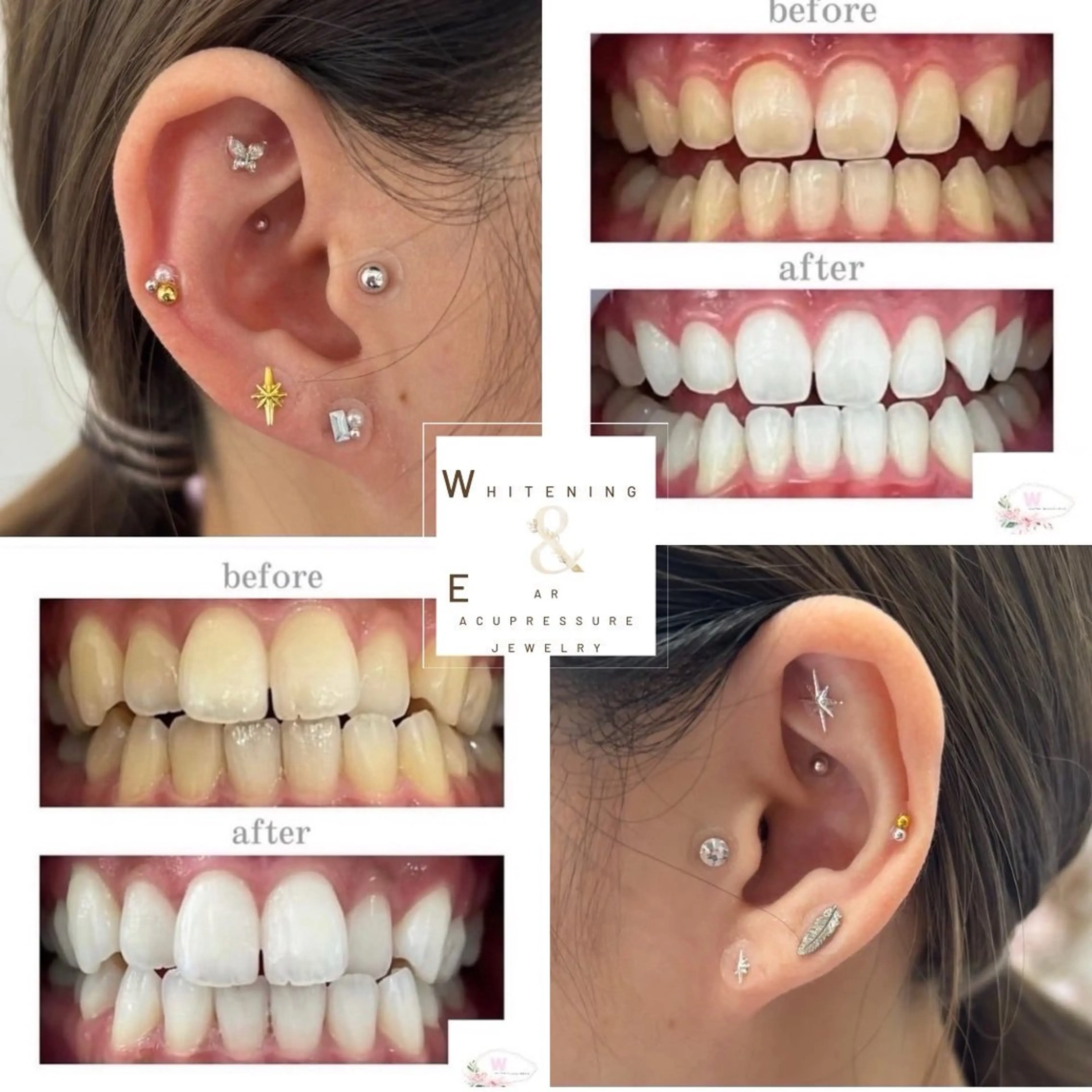 キッズ ホワイトニング ショップ本厚木のその他イメージ