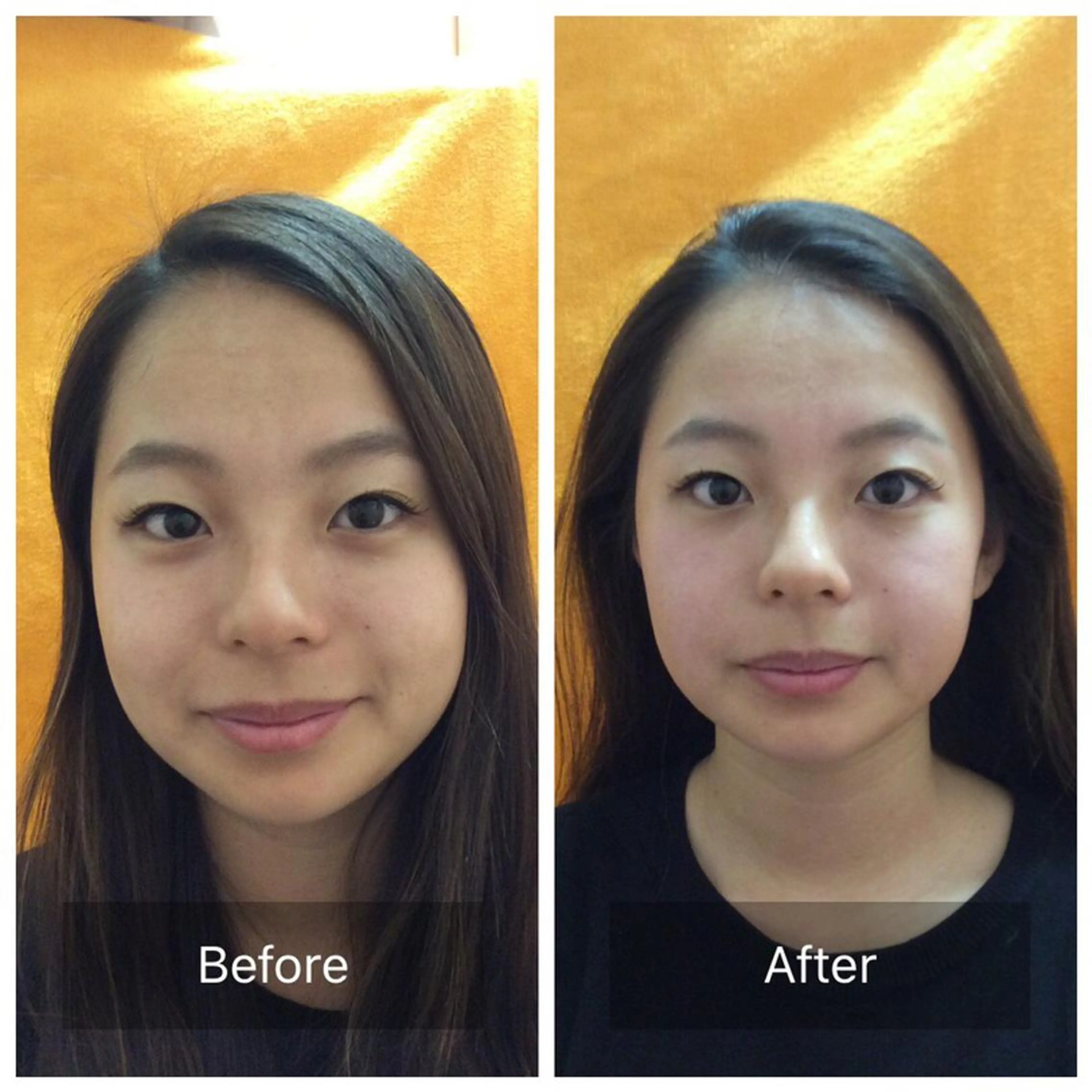 美容鍼×小顔矯正× 美容整体/小林幸司のエステ・リラクイメージ