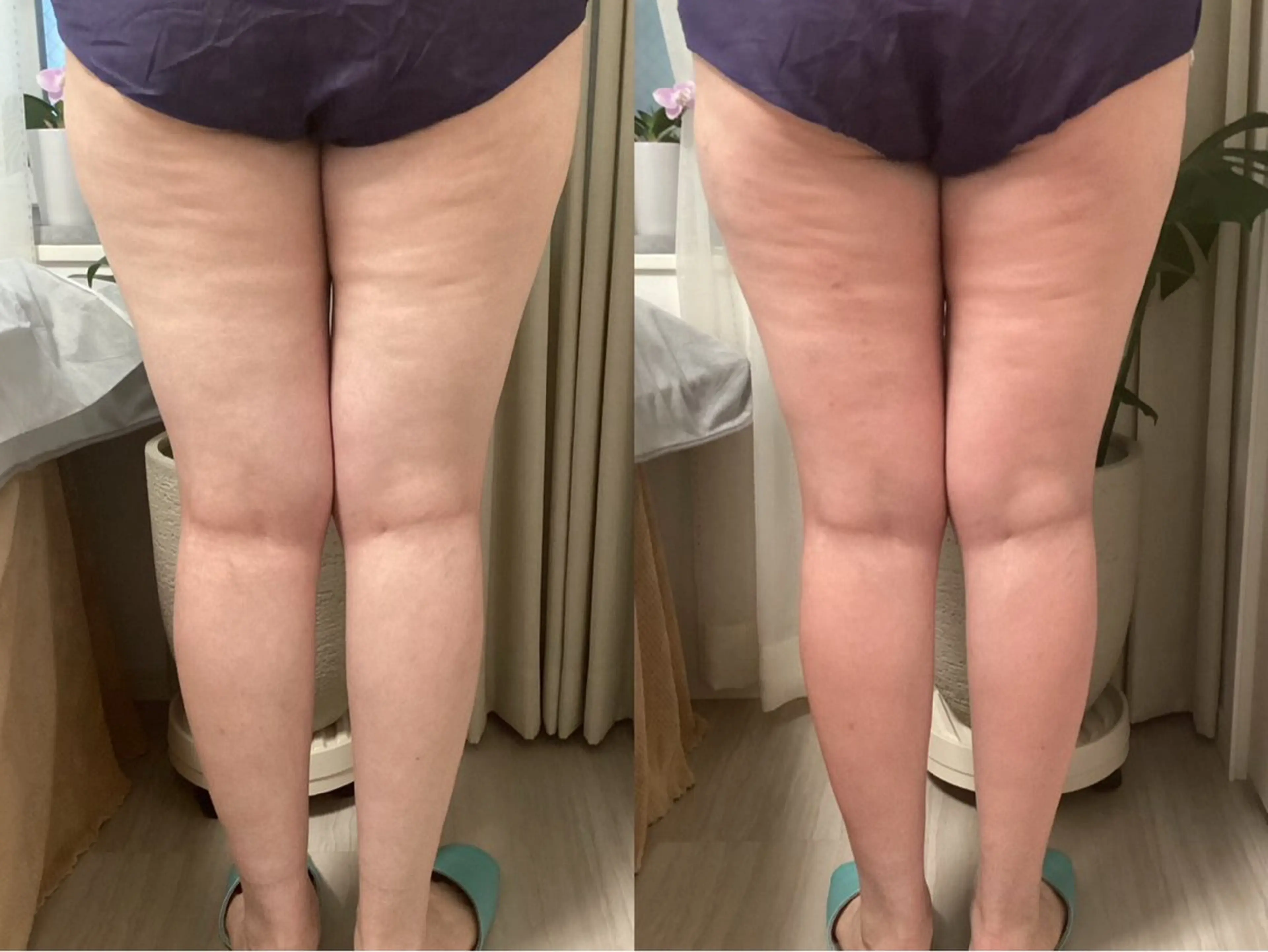 エステ リラク ホワイティアビシェル ウラワ　白澤奇のエステ・リラクイメージ