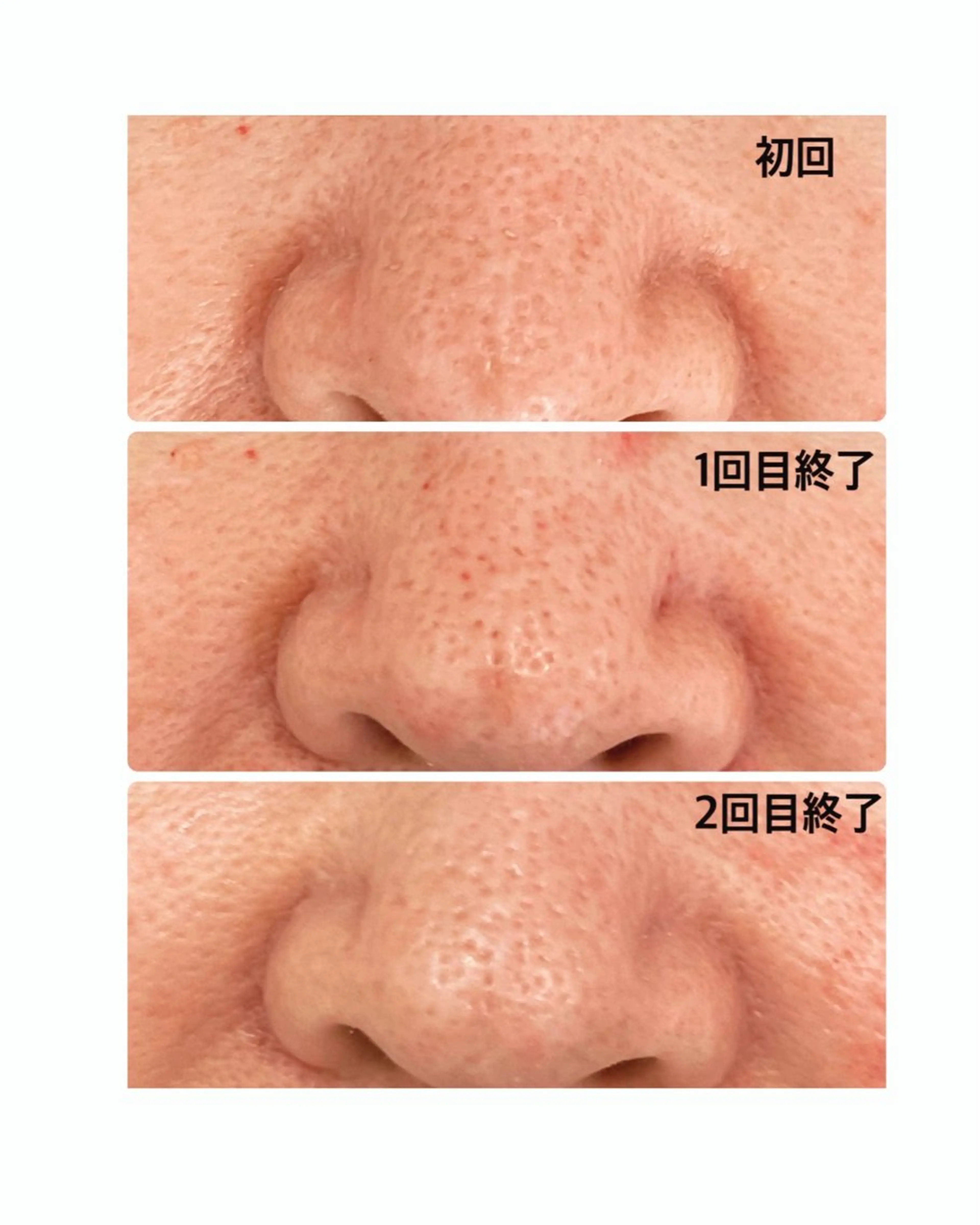 温活美肌専門サロン Lien『リアン』のエステ・リラクイメージ