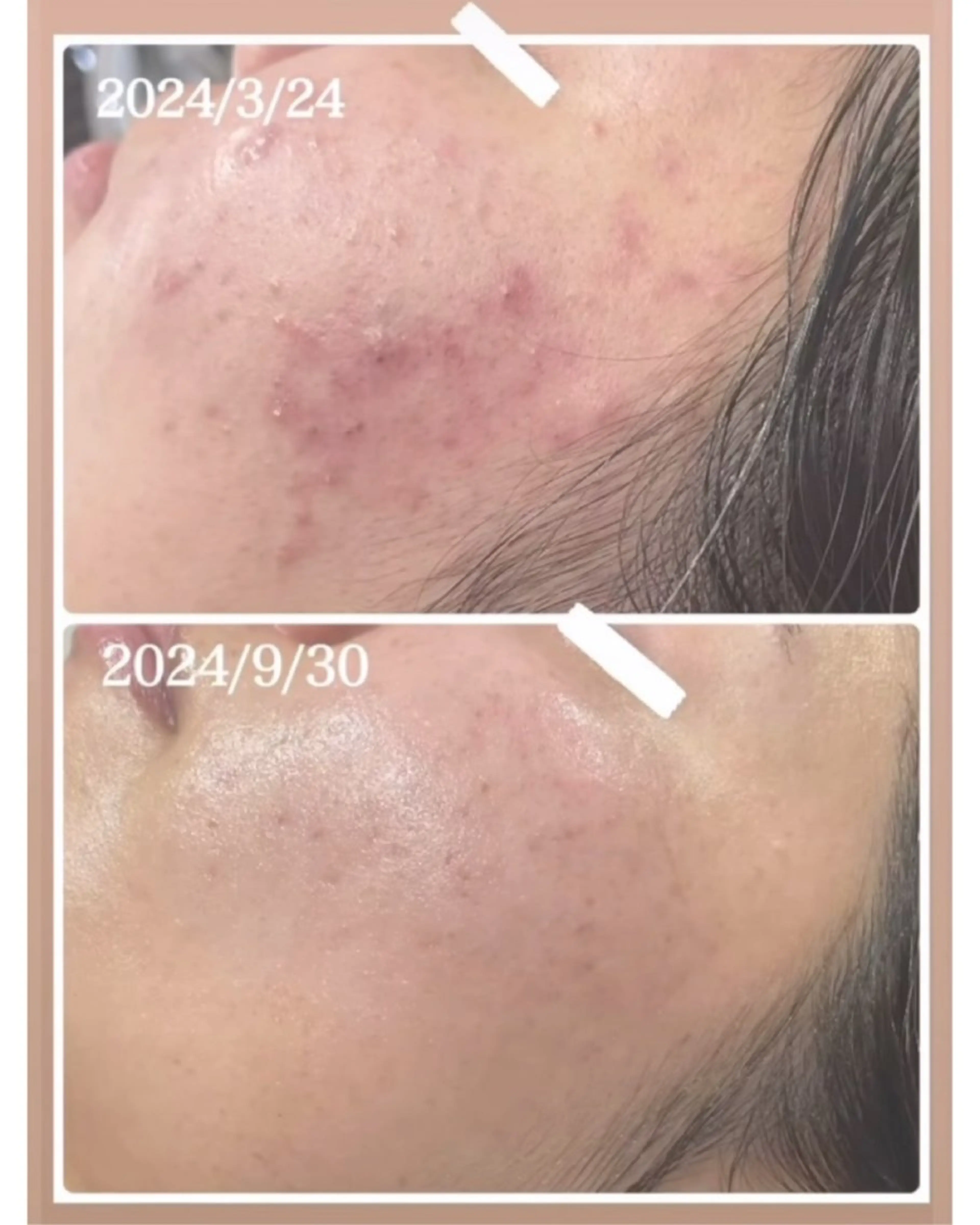 nature  s oin ICHIKAのエステ・リラクイメージ